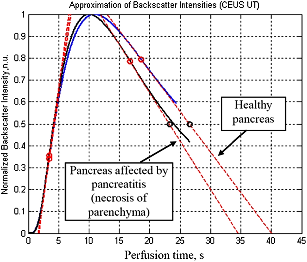 Reconstructed normalized perfusion dynamic curves by approximations of log-normal distributions for healthy volunteer and patient with pancreas affected by necrosis.