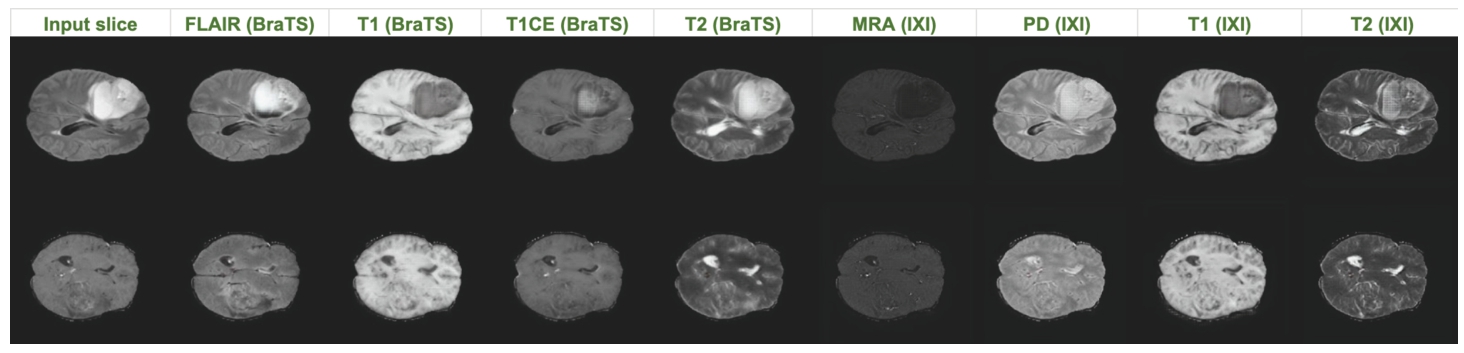 Illustration of multi-contrast MRI synthesis on BraTS2020 and IXI datasets.