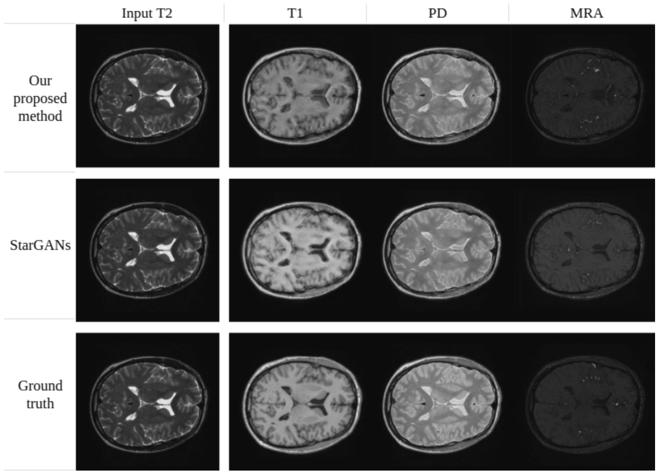 Synthesis of MRA, PD-weighted and T1-weighted images using a single T2-weighted image as input (IXI dataset).