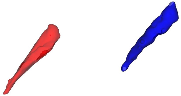 The original adductor brevis muscle in red and its RBF counterpart in blue.