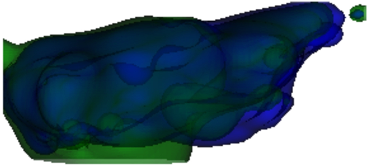 The final part of the shape restoration. The green shape found other local minima than the muscle’s blue (original) shape.