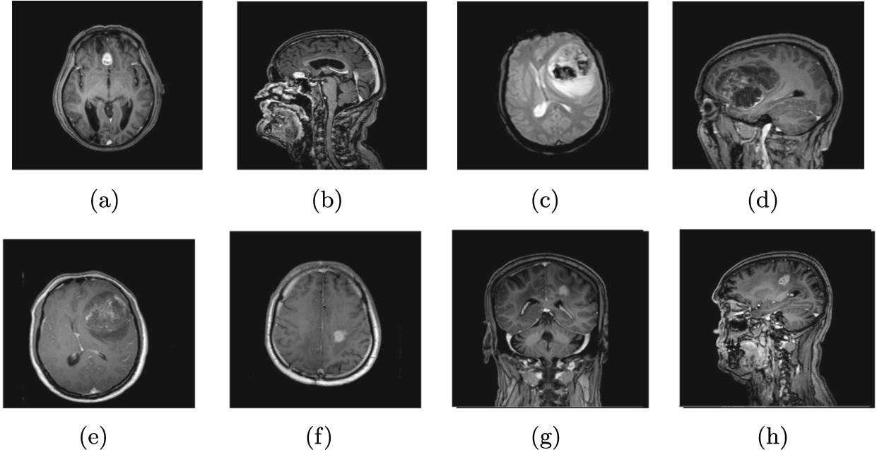 Original brain images.