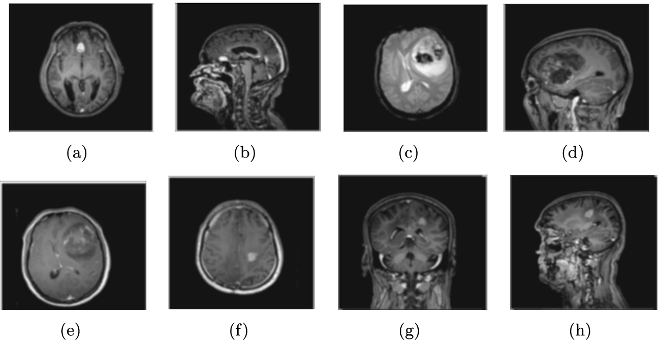 Blurred brain images.