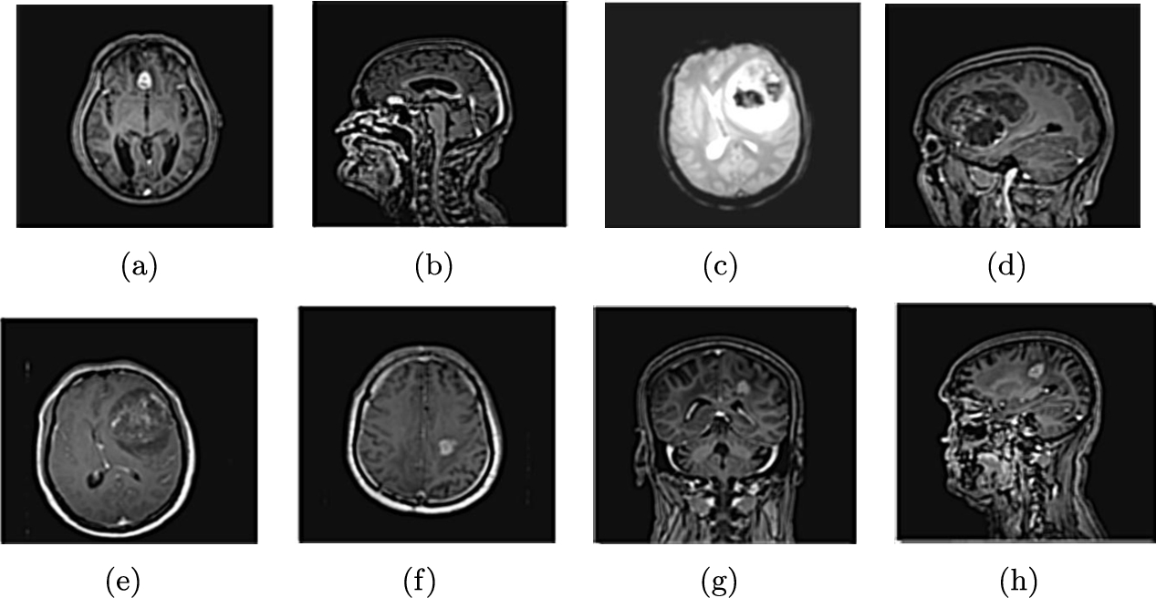 Deblurred brain images.