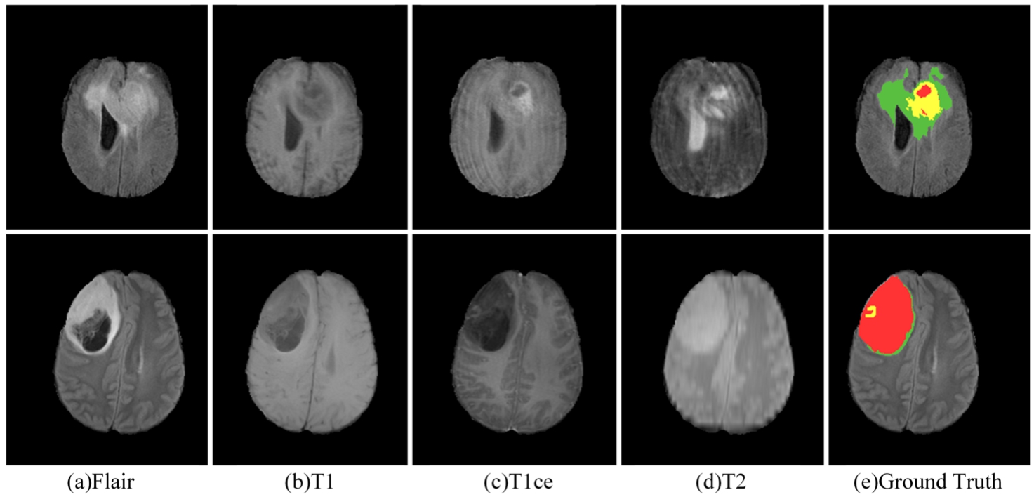 MRI in different modes and ground truth.