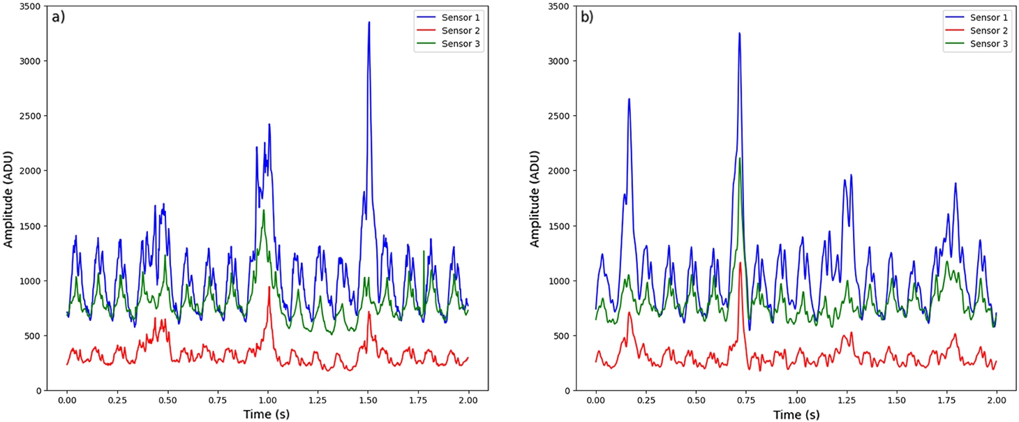 CB tension signals: a) original signal; b) TimeVAE generated signal.