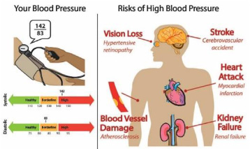 Hypertension infographic.