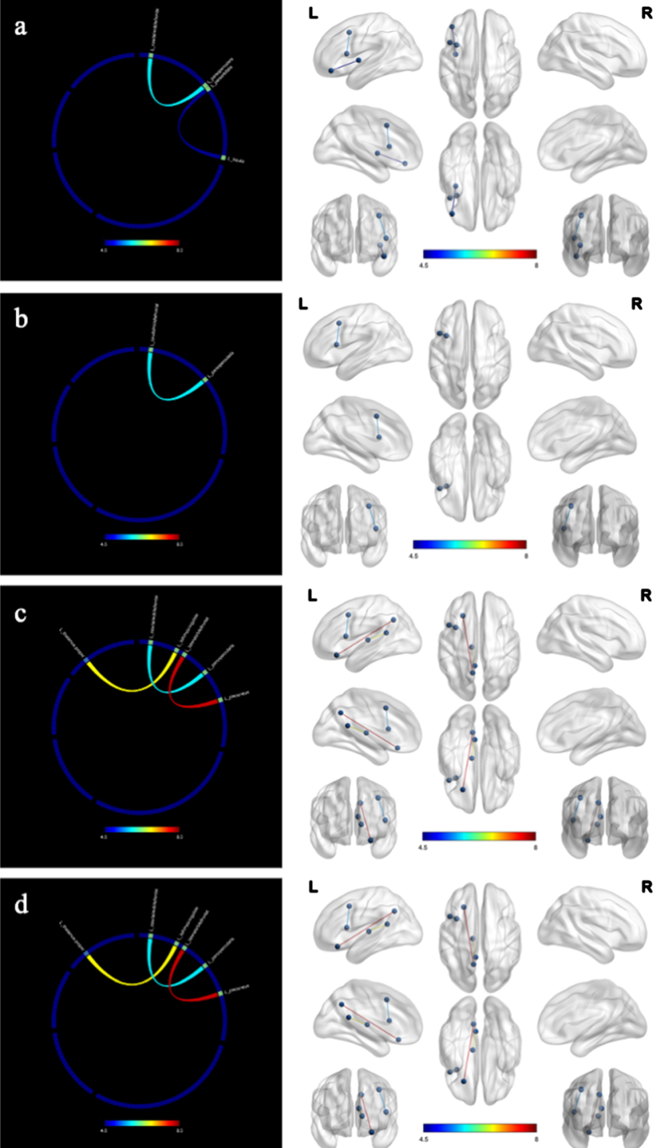 Changes in structural connectivity (diffusion-weighted imaging) after the intervention. a) language; b) executive; c) memory; d) recall; L, left; R, right. The intervention group showed improved in structural connectivity compared to the control group. The marked color of connecting line in the figure indicates the F value.