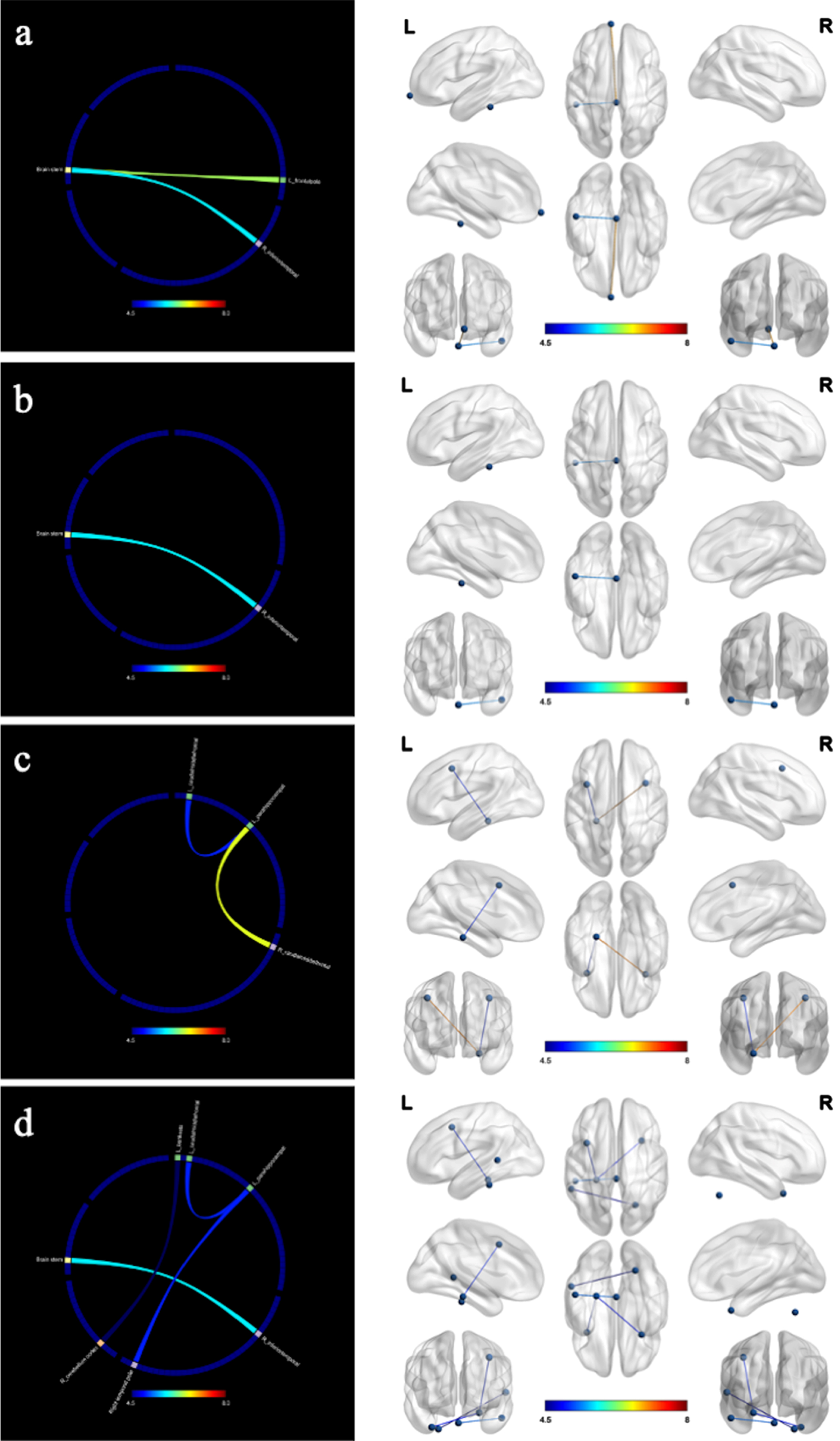 Changes in functional connectivity (resting state) after the intervention. a) concentration; b) executive; c) memory; d) recall; L, left; R, right. The intervention group showed improved in functional connectivity compared to the control group. The marked color of connecting line in the figure indicates the F value.