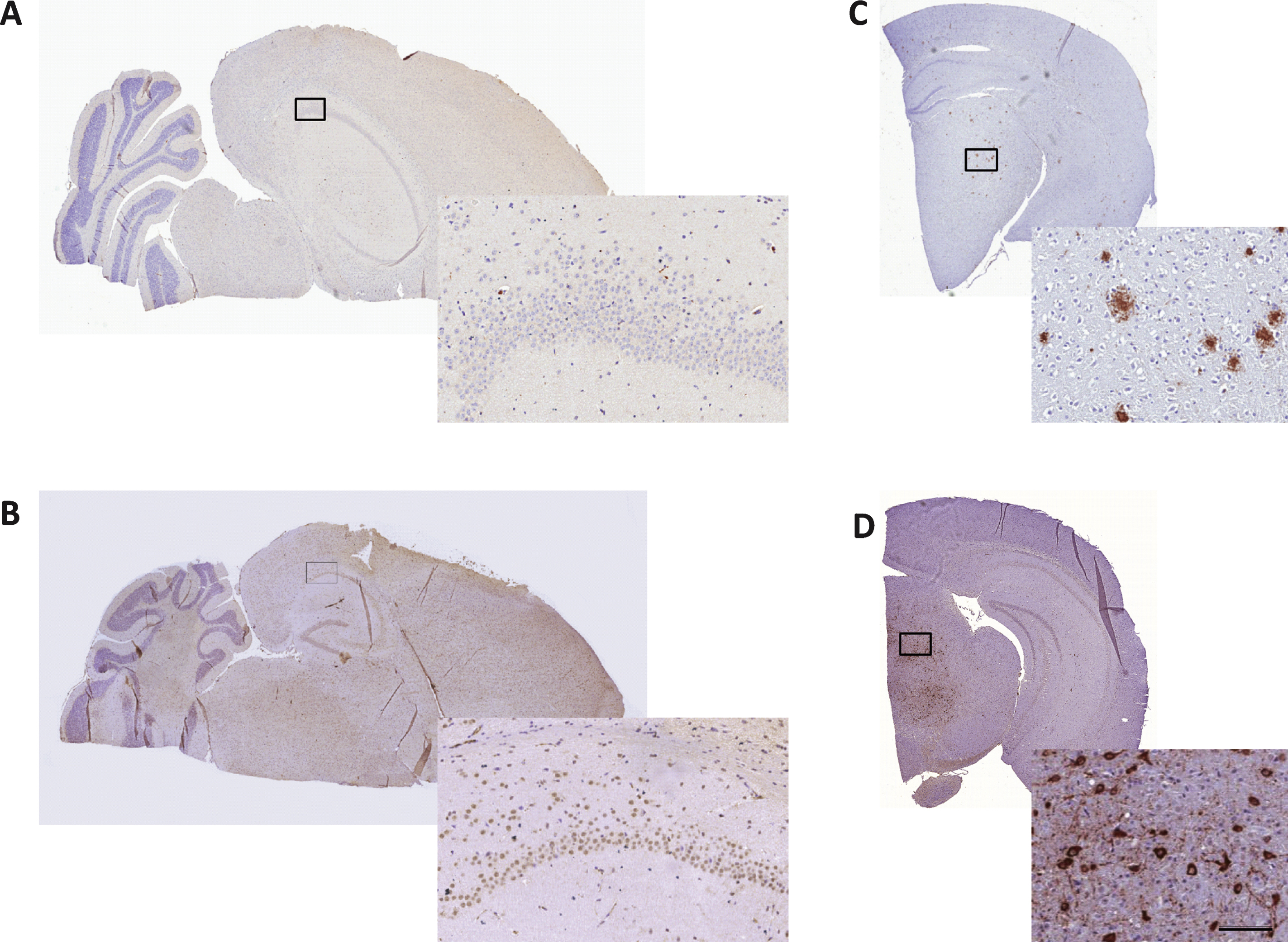 Immunohistochemical analysis of Aβ and neurofibrillary tangles in SAMP8 mouse brains. 10-month-old SAMP8 mice showed no presence of amyloid plaques or neurofibrillary tangles. Representative photomicrographs of Aβ (A) and phospho-tau (B) immunohistochemical staining of 5- μm thick brain sections from 10-month-old SAMP8 mice. Immunohistochemical control samples for amyloid plaques (C, AβPP/PS1 mouse) and neurofibrillary tangles (D, hTau P301L mouse) are inserted. Enlarged photos represent corresponding framed area on each specimen (scale bar = 100 μm).
