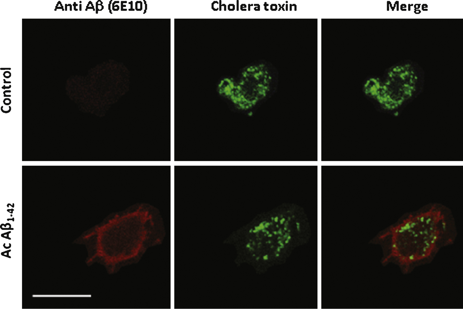 Aβ1–42 partially
co-localizes with cholera toxin on the surface of PC12 cells. Aβ1–42 immunochemical detection on PC12 cells. Cells were incubated with either 1 μM Aβ42–1 (the reverse peptide as a control condition) or with 1 μM Aβ42 (Ac Aβ1–42) prior to fixation and immunolabeling for Aβ1–42 (red) and cholera toxin (green). Aβ1–42 as revealed by the monoclonal antibody 6E10 (directed against every form of the peptide) partially colocalized with membrane microdomains revealed by cholera toxin as quantified by a Pearson coefficient of 0.23 ± 0.03. Calibration bar 20 μm.