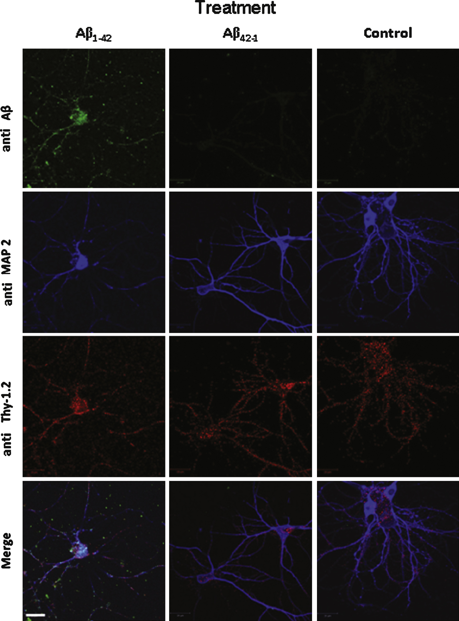 Aβ42 binds and partially colocalizes with Thy1 on the surface of cultured neurons. Aβ1–42 immunochemical detection on cultured mouse cortical neurons. Cells were incubated either with 1 μM Aβ1–42 or with 1 μM Ab42–1 as a control or with the vehicle solution prior to fixation. Aβ1–42 was revealed by the 6E10 monoclonal antibody (green) and two other neuronal markers were used to characterize the neuronal phenotype of the cells: Thy-1 (red), which is a membrane marker, and MAP2 (blue), a cytoplasmic marker. No Aβ label was detected in control conditions (vehicle solution applied to the cells). Calibration bar 20 μm.