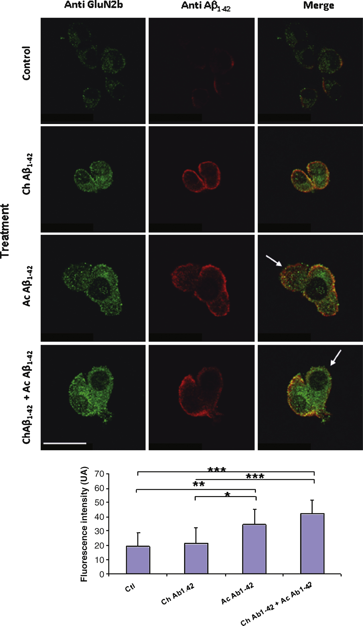 Aβ42 binding to PC12 cells is correlated with an increase in the membrane expression of GluN2B. Fixed PC12 cells were incubated with primary antibodies directed against GluN2B subunit (green) and Aβ42 (red). The chronic treatment with 10 nM Aβ1–42 monomers did not produce a significant increase of GluN2B immunoreactivity. The fluorescence intensity related to GluN2B increased when the cells were incubated with 1 μM oligomeric Aβ1–42 as illustrated by the lower panel. Note that the two antigens are partially colocalized. However in some cells this colocalization appears weak suggesting a heterogeneity among PC12 cells (white arrows). (Crl: vehicle application as control; Ac: acute 1 μM Aβ application; Ch: chronic 10 nM Aβ incubation; Statistics: one way ANOVA and subsequent Bonferroni test;  *p <  0.05;  **p <  0.01; ***p <  0.001). Calibration bar 20 μm.