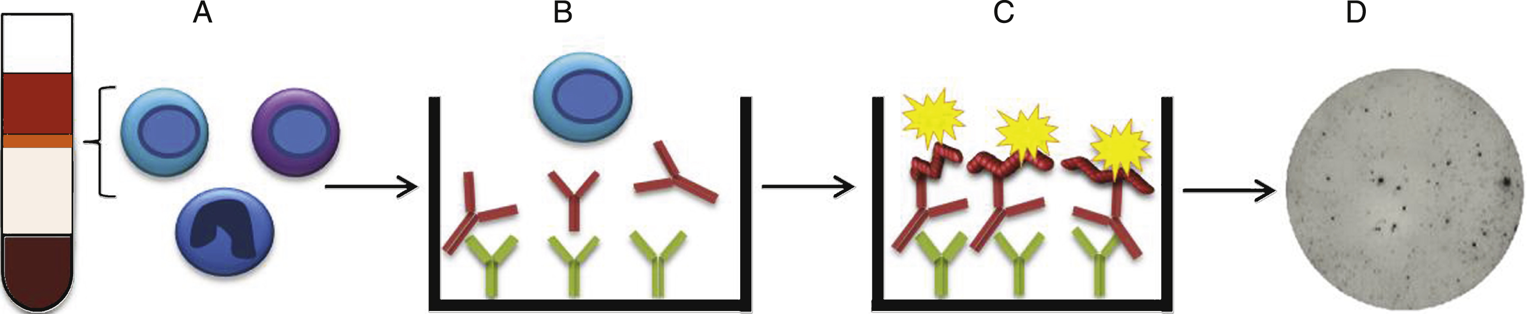 B cell ELISpot. A) PBMCs were collected by Ficoll-Paque separation, stimulated with R848 and hIL-2 to start their antibody production and B) added to ELISpot wells coated with anti-IgG capture antibodies. C) Biotinylated Aβ binds to the captured anti-Aβ antibodies secreted from the activated B cells. D) The dots representing cells secreting anti-Aβ antibodies were visualized by Streptavidin-ALP.