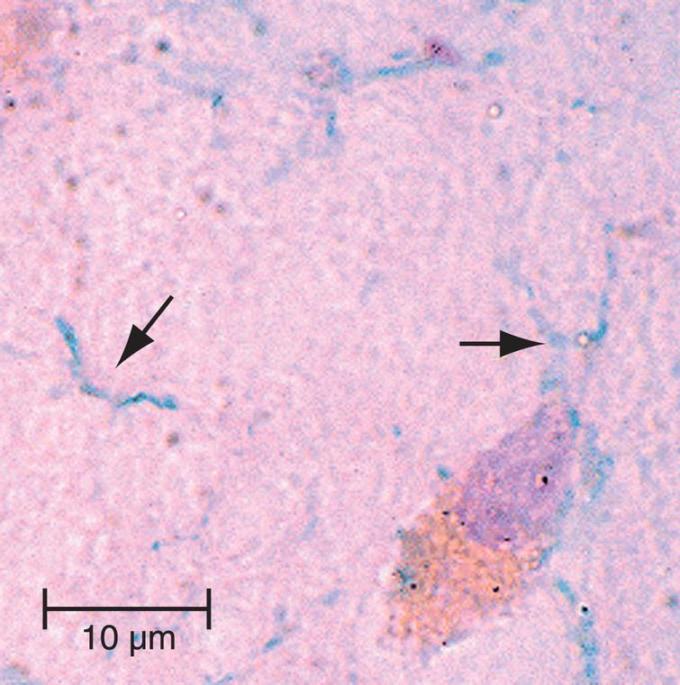 Image of oral spirochetes in Alzheimer’s disease brain. The oral spirochete T. pectinovorum stained dark blue (arrows) in a section from the hippocampus from an 84-year-old woman with Alzheimer’s disease. The section was incubated with monoclonal antibodies to T. pectinovorum, and binding was disclosed using biotinylated anti-mouse antibodies and avidin-peroxidase. The photomicrograph was taken at1000X. Scale bar = 10μm. Figure from Riviere GR, Riviere KH, Smith KS (2002) Molecular and immunological evidence of oral Treponema in the human brain and their association with Alzheimer’s disease. Oral Microbiol Immunol 17, 113-118 [127]. Copyright 2002. Reprinted with permission from John Wiley and Sons, Inc. and George Riviere.