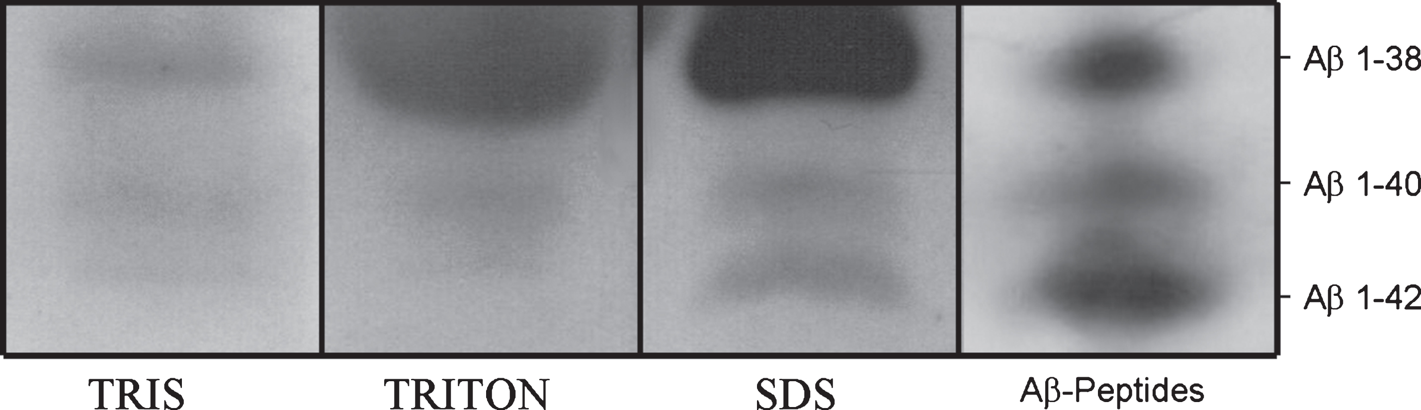 Western blot analysis of Aβ using 6E10 antibody. Aβ peptides 1–38, 1–40, and 1–42 in Tris, Triton, and SDS fractions of cattle cortex pools. Synthetic Aβ peptides were used as controls.