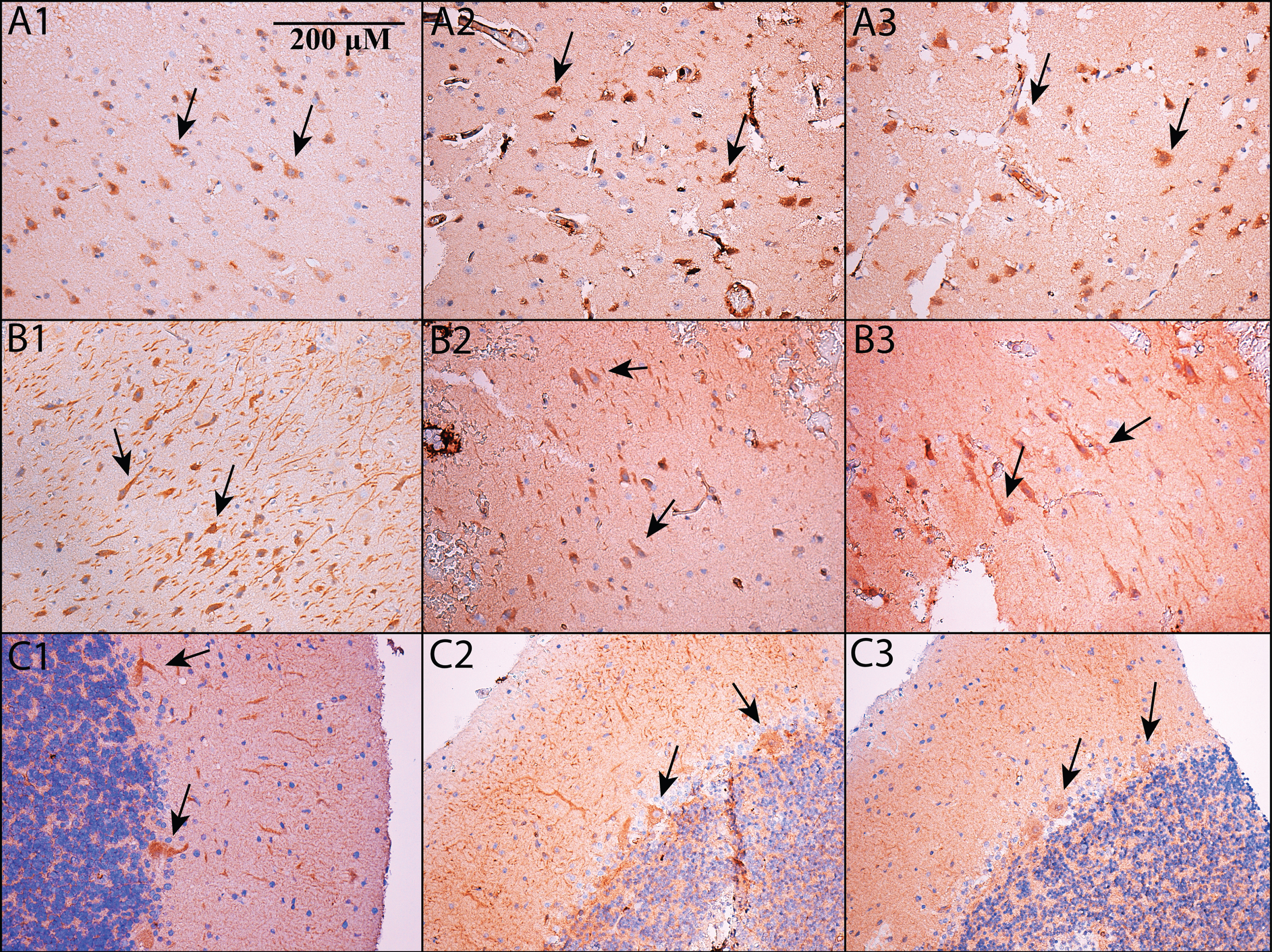 PDE5 is expressed in neurons. Immunohistochemistry was performed on formalin-fixed, paraffin embedded sections of cortex (A1-A3), hippocampus (B1-B3; shown is subfield CA2/3 – see main text for details) and cerebellum (C1-C3). All images are shown at 200x magnification; the scale bar in Panel A1 applies to all panels. Panels A1, B1, and C1 use an Abcam antibody, panels A2, B2, and C2 use a Santa Cruz antibody, and panels A3, B3, and C3 use an Atlas antibody (see Methods). In all cases, PDE5 is expressed in the cytoplasm of neurons. In cortex and hippocampus, PDE5 is expressed primarily in large, pyramidal-type neurons (see arrows), whereas in cerebellum, it is prominent in Purkinje neurons (see arrows).