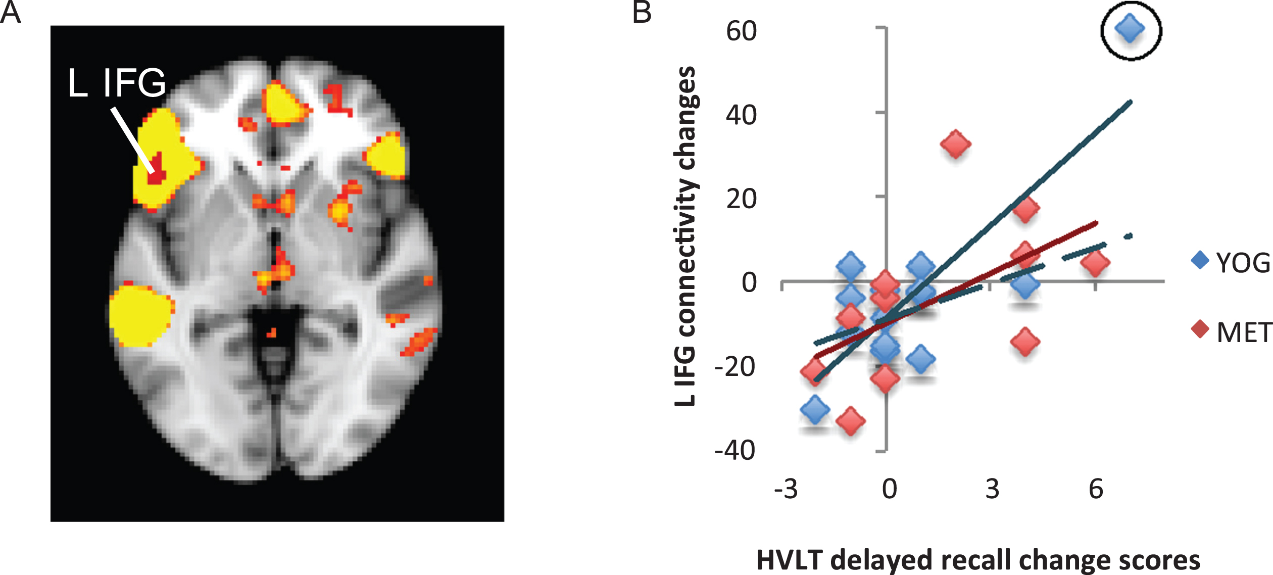 Changes in functional connectivity within the language network correlated with improved verbal memory. A) The language resting-state network is displayed in yellow on a template brain in neurological orientation. A single region in the left inferior frontal gyrus (L IFG) showed a significant positive correlation between changes in language-network connectivity and improved verbal memory measured with the Hopkins Verbal Learning Test (HVLT). This region is displayed in red (z <  2.3, p <  0.05, corrected). B) A scatter figure displays the positive correlation for the L IFG cluster shown in A for yoga (YOG, blue) and memory enhancement training (MET, red) groups. Trendlines are displayed for each group, including a dashed line for a trendline with an outlier (circled in black) removed for the yoga group.
