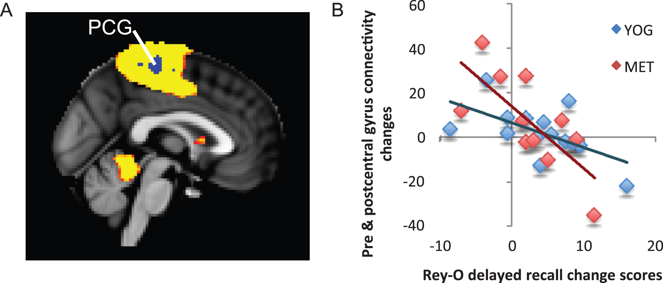 Changes in functional connectivity within the superior parietal network correlated with changes in visuospatial memory. A) The superior parietal resting-state network is displayed in yellow on a template brain. A single region near the pre- and post-central gyri (PCG) showed significant negative correlation between changes in connectivity with the superior parietal network and changes in visuospatial memory measured by the Rey-Osterrieth Complex Figure Test (Rey-O). This cluster is displayed in blue (z <  2.3, p <  0.05, corrected). B) A scatter figure displays the negative correlation for the PCG cluster displayed in A for the yoga (YOG, blue) and memory enhancement training (MET, red) groups. Trendlines are displayed for each group.