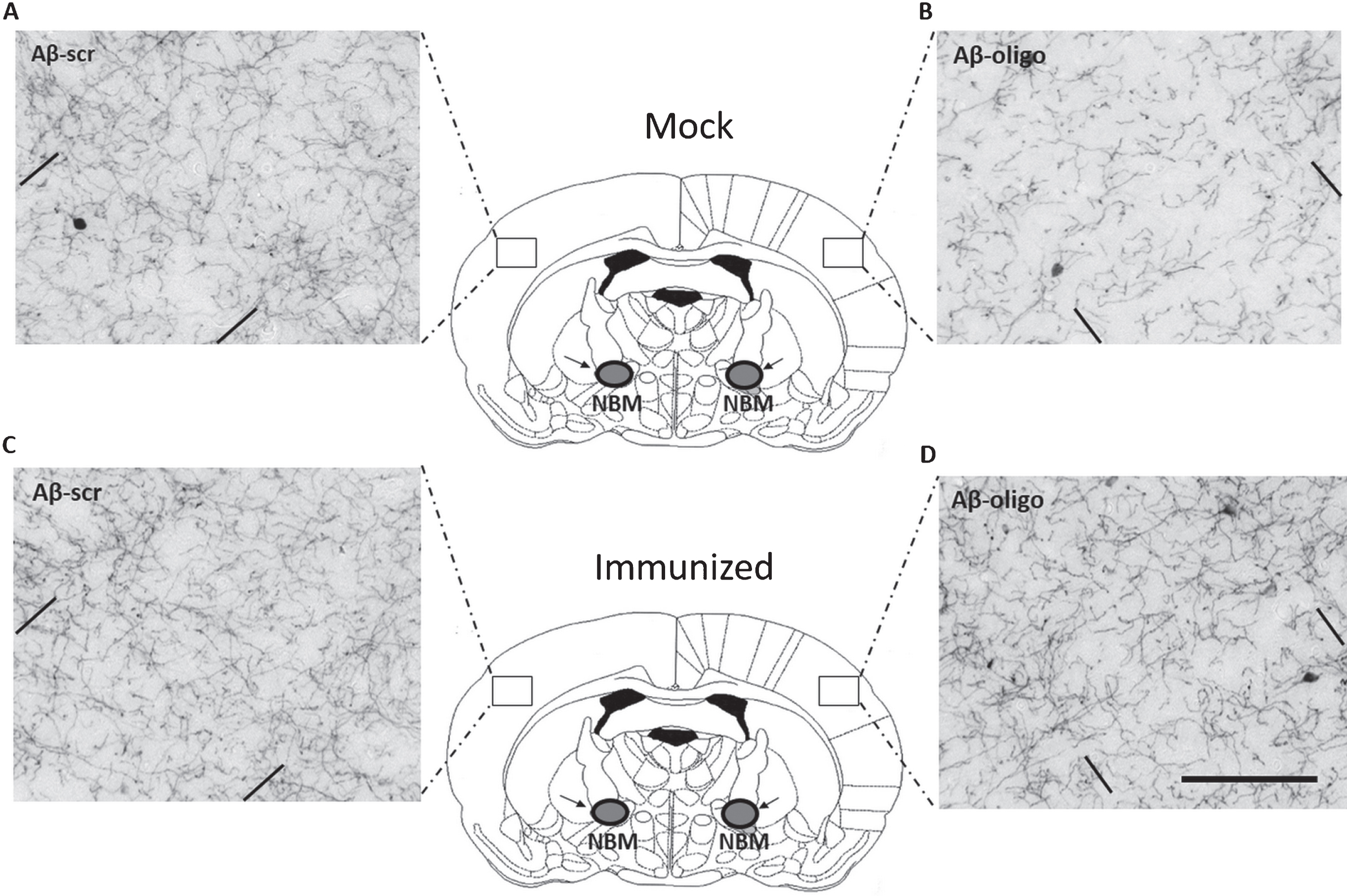 Active immunization prevents the loss of cholinergic innervations induced by oligomeric Aβ1-42 injected into the NBM. Shown are representative images of ChAT-positive fibers in the parietal neocortex of mock (A and B) and immunized mice (C and D). Images on the left (A and C) show the side of the brain injected with scrambled Aβ1-42 control peptide (Aβ-scr). Images on the right (B and D) show the contralateral lesion-sides of the brain injected with oligomeric Aβ1-42 (Aβ-oligo). Note that in practice the compounds were randomly injected in the left- or right side of the brain. Comparing control and lesion sides of the brain, immunized mice show reduced fiber loss compared to mock mice. In each image the area between the parallel bars indicate the quantified area (layer V of the somatosensory cortex). The horizontal scale bar shown in (D) applies to all images and represents 100 μm.