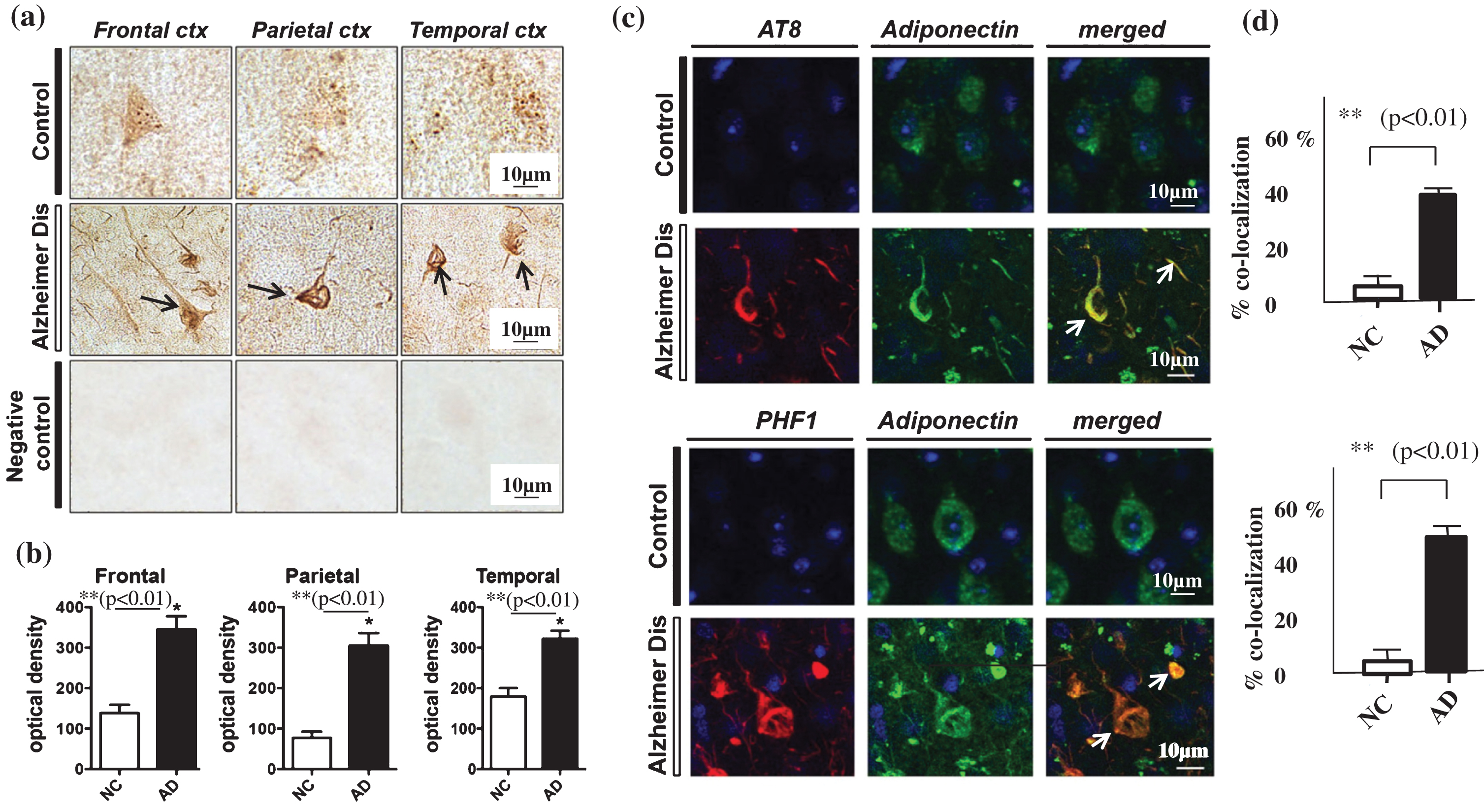 Neurohistochemistry using immunostaining with anti-APN antibody. a) Immunohistochemistry using a polyclonal anti-APN C-terminal antibody in samples from the frontal, parietal and temporal cortex showed strong staining of neurofibrillary tangles (NFTs) in AD brains (middle panel, black arrows), but not in control brains (upper panel). Negative control brain sections treated with secondary antibody without anti-APN antibody showed no staining, indicating the specificity of the anti-APN antibody (lower panel). b) Quantification using Image J showed that the optical density of APN-positive NFTs in (a) was significantly higher in AD brains compared to control brains (p < 0.01). c) Confocal laser scanning microscopy of control and AD brains using anti-tau antibodies AT8 (upper) and PHF (lower), and anti-APN antibody showed that APN co-localized with tau in AD. White arrows indicate NFTs identified by the presence of AT8 or PHF-1 immunoreactive abnormal fibrous inclusions, which were within the perikaryal cytoplasm of neurons. d) Quantification with Image J showed that co-localization of APN with NFTs was significantly higher in AD brains than in control brains (p < 0.01). Scale bar = 10 μm.