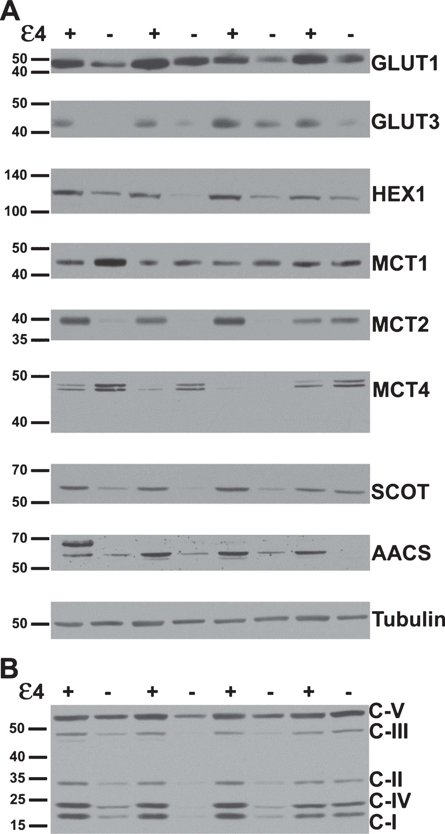 Several key metabolic proteins show altered expression in APOE4 carriers. A) Representative western blots of proteins underlying brain glucose and ketone metabolism. Each protein target was analyzed with a separate probe; however, GLUT1, GLUT3, MCT1, and MCT4 results shown here align to the same subjects. Similarly, HEX1, MCT2, SCOT, and AACS shown here align to the same second set of subjects. Analysis proceeded on three such sets in total for each target (N = 24), in triplicate. B) A representative western blot resulting from application of the antibody cocktail against mitochondrial oxidative phosphorylation protein subunits. Analysis proceeded on three such sets (N = 24), in triplicate.
