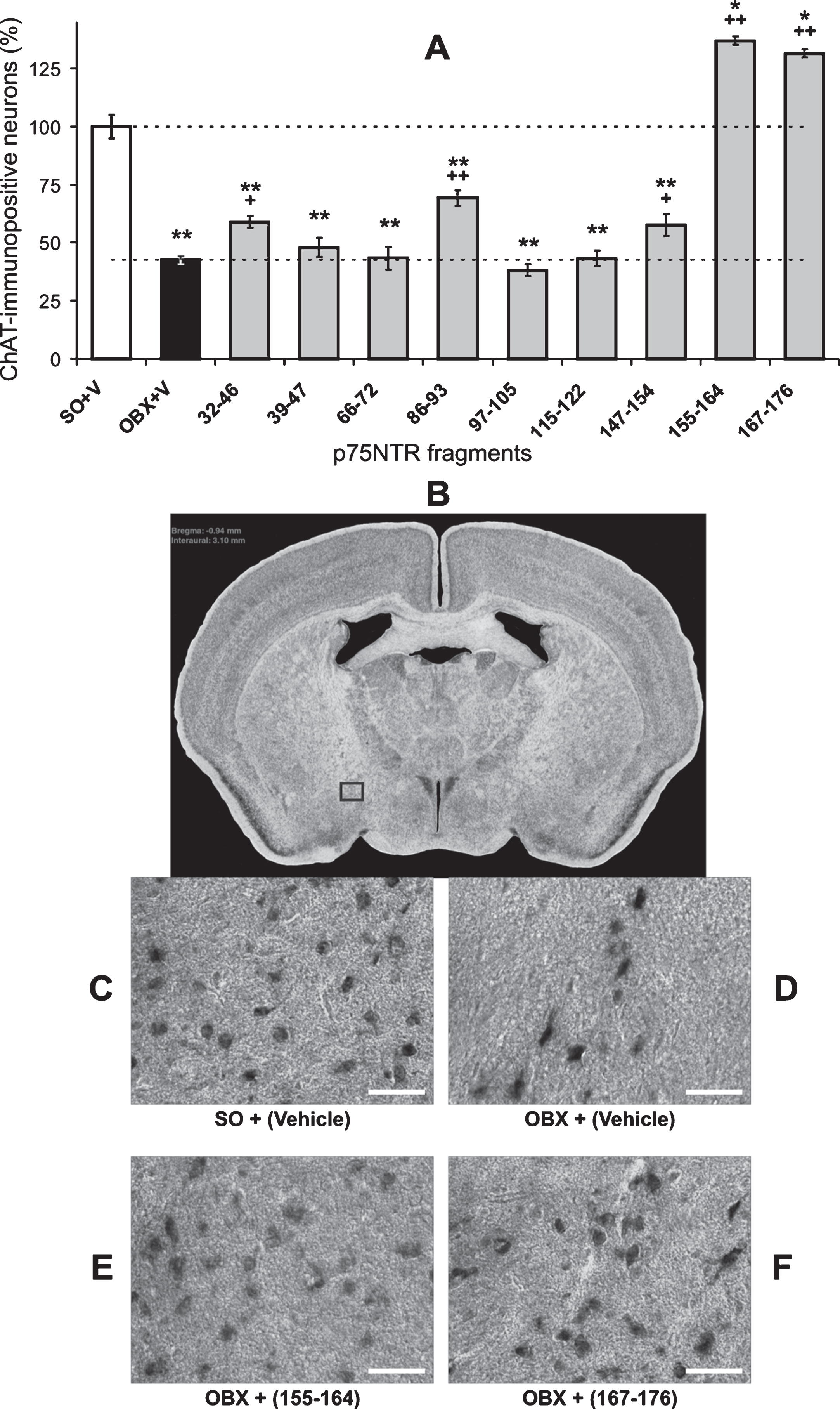 Detrimental effect of olfactory bulbectomy (OBX) in mice on the density of choline acetyltransferase (ChAT)-containing neurons in the forebrain, beneficial effects of the immunization against the p75NTR amino acid residues of 32–46, 86–93, and 147–154, and overgrowing effects of the treatment with 155–164 and 167–176 fragments. The immunoreactive labeling against ChAT in the nucleus basalis magnocellularis on the representative examples (taken from the area marked by a rectangle on B) demonstrates decreased number of the labeled cells after the bulbectomy (c.f., C and D) and their recovery after the immunization against the fragments of 155–164 (E) and 167–176 (F). White horizontal bars in C-F are the scale bars of 50 μm. On A, error bars show 1 SEM; star or plus denote significant differences versus either SO or OBX, respectively (one and two markers are p < 0.05 and 0.01, Mann-Whitney U-test). The brain slice on B was modified from [40].