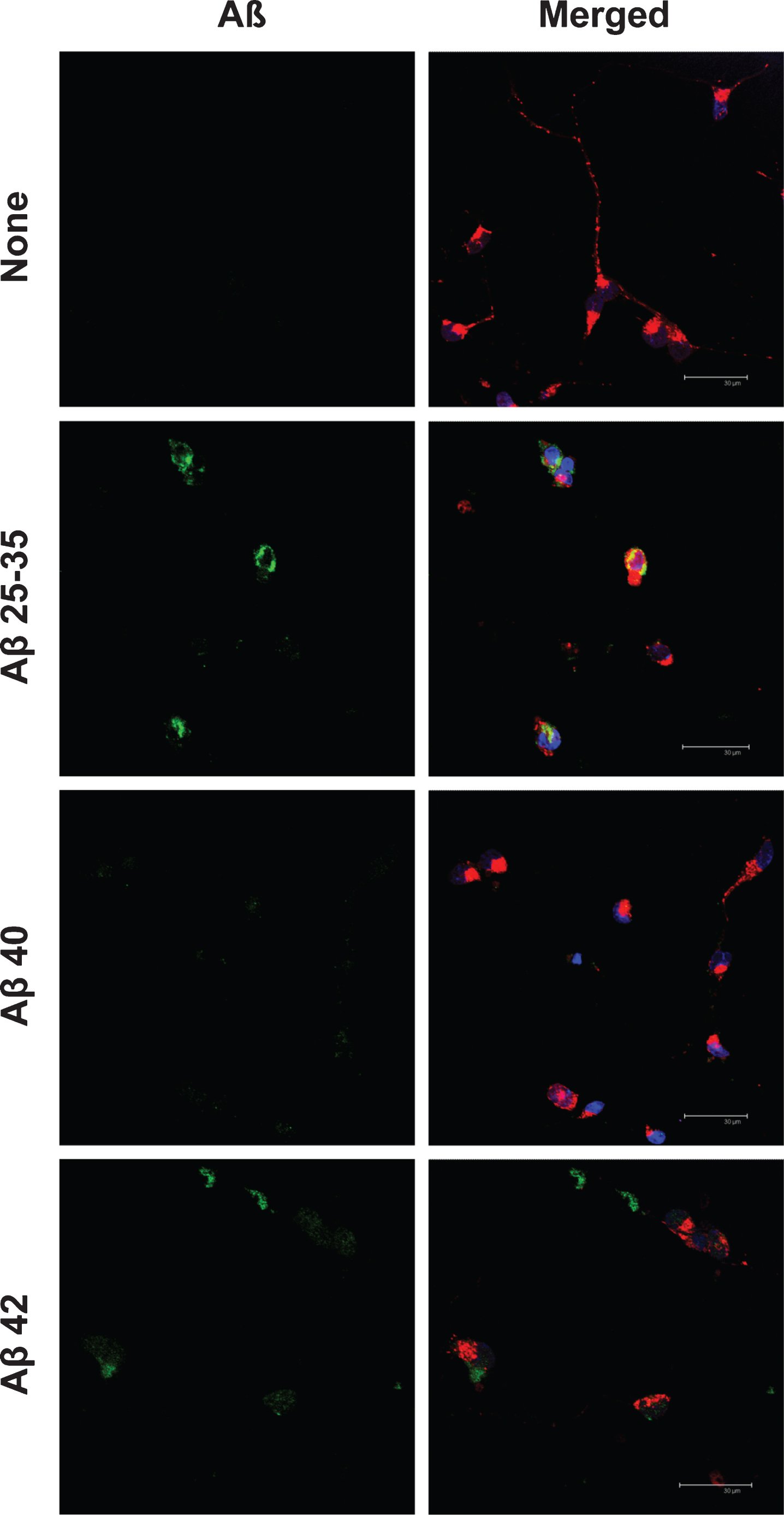Cellular localization of amyloid-beta peptides in neurons in primary culture. Neurons in primary culture (3 DIV) were incubated for 5 h in Hanks medium with three different Aβ peptides: Aβ25-35, Aβ40, or Aβ42 (30 μM). After incubation, neurons were stained with MitotrakerRed, a mitochondrial marker (in red) and then were fixed. Immunocytochemistry against each Aβ was performed (in green) and nuclei were stained with TOPRO (in blue). Images were taken using confocal microscopy. Scale bar: 30 μm.