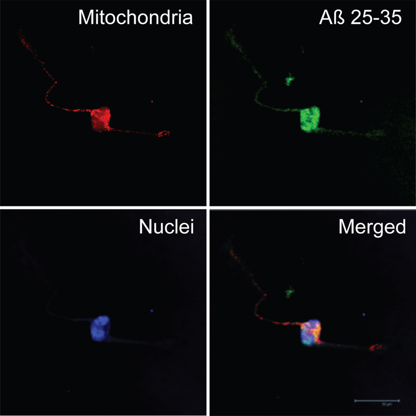 Subcellular localization of amyloid-beta25-35 (Aβ25-35). Neurons in primary culture (3 DIV) were incubated for 24 h in Hanks medium in the presence of Aβ25-35 (30 μM). After incubation, mitochondria were stained with MitotrackerRed (in red), and cells were fixed. Immunocytochemistry against Aβ25-35 was performed (in green) and nuclei were stained with TOPRO (in blue). Images were taken using confocal microscopy. Scale bar: 30 μm.