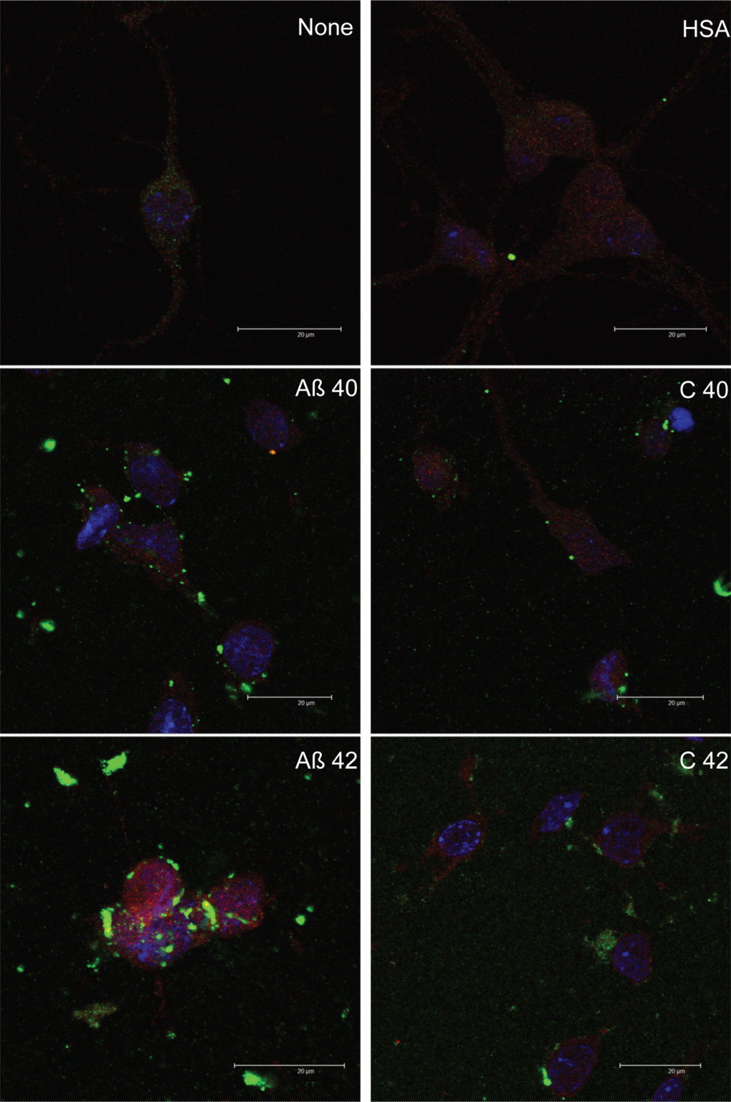 Effect of HSA on amyloid-beta cell entry. Neurons in primary culture (3 DIV) were incubated for 2 h in Hanks medium in the presence of 30 μM of Aβ40, Aβ42, or HSA-Aβ complexes (C40, C42). After incubation, cells were fixed and immunocytochemistry against glucose transporter 3 (in red) and against AβPP (in green) was carried out. Nuclei were stained with TOPRO (in blue). Images were taken using confocal microscopy. Scale bar: 20 μm.