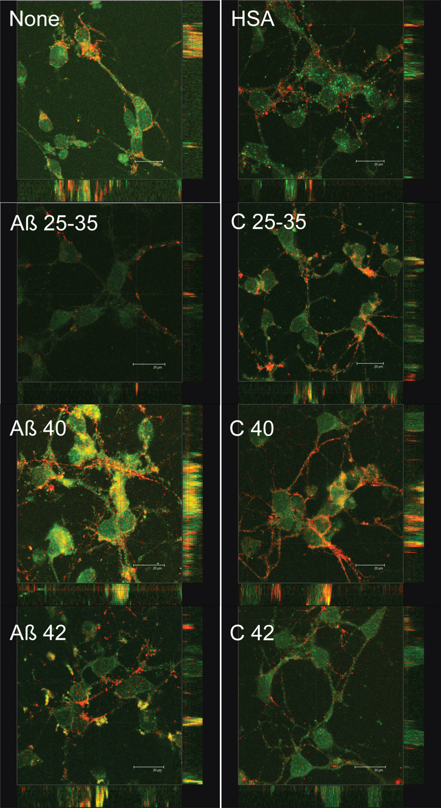 Effect of amyloid-beta peptides on PSD-95 and synaptotagmin localization. Neurons in primary culture (4 DIV) were incubated for 2 h in Hanks medium in the absence or the presence of 30 μM Aβ25-35, Aβ40, Aβ42, HSA, or HSA-Aβ complexes (C 25–35, C 40, C 42). After incubation, cells were fixed and immunocytochemistry against PSD-95 (in green) and against synaptotagmin (in red) was carried out. Images were taken using confocal microscopy. Orthogonal projections along the z-axis of the images are shown at the bottom and right. Scale bar: 20 μM