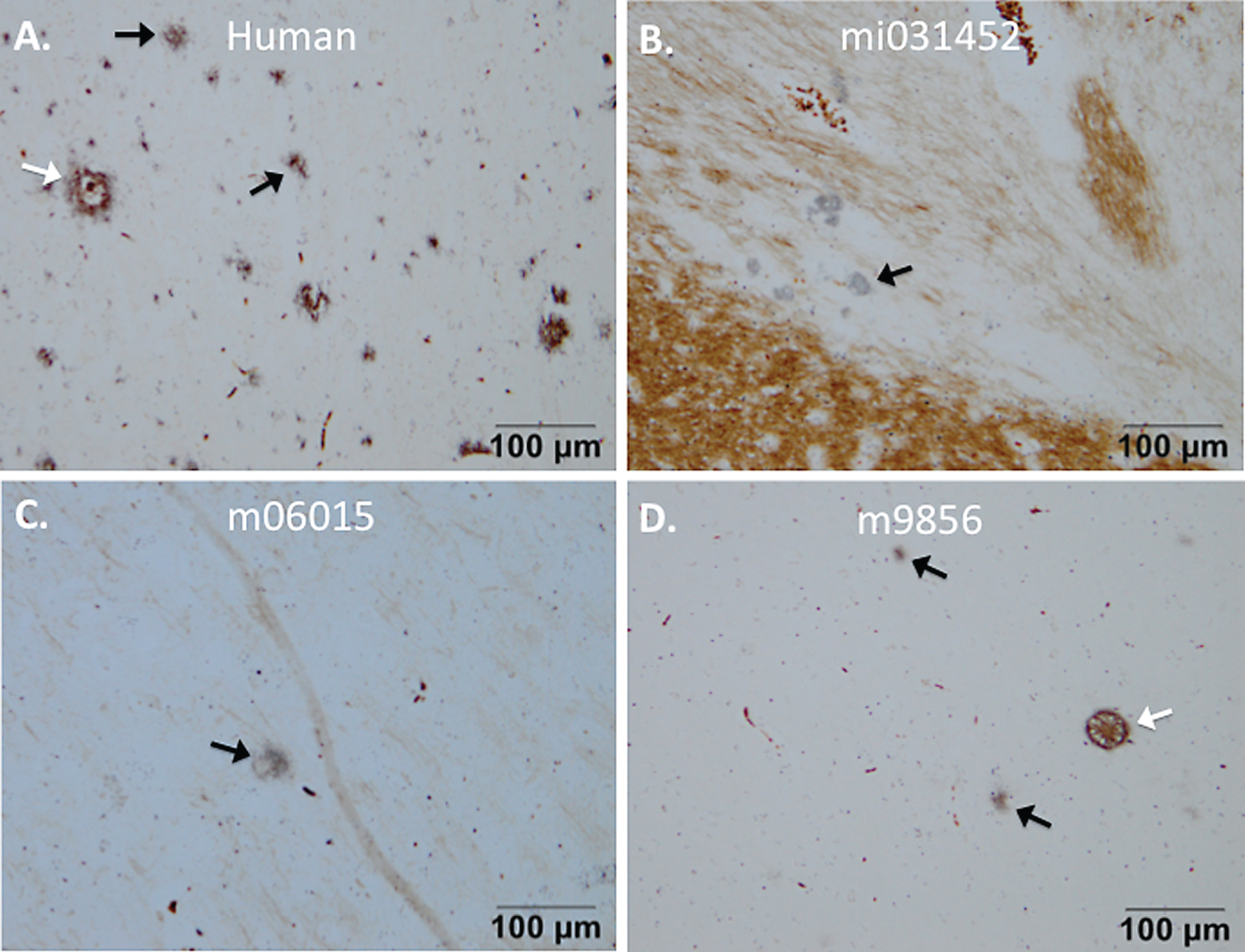 Senile plaques visualized with Campbell-Switzer staining. Senile plaque formation was present in brain material of an AD patient (A) and also natural (early) amyloidosis was present in the common marmoset (B) that died at an age of six due to wasting syndrome (mi031452). Experimental monkeys m06015 and m9856 that were injected with the Aβ combined with LPS also demonstrated amyloidopathy (C, D). The plaques in monkey m06015 were solely found in the right hemisphere. Diffuse plaques are indicated with a black arrow and dense-core plaques are indicated with a white arrow.