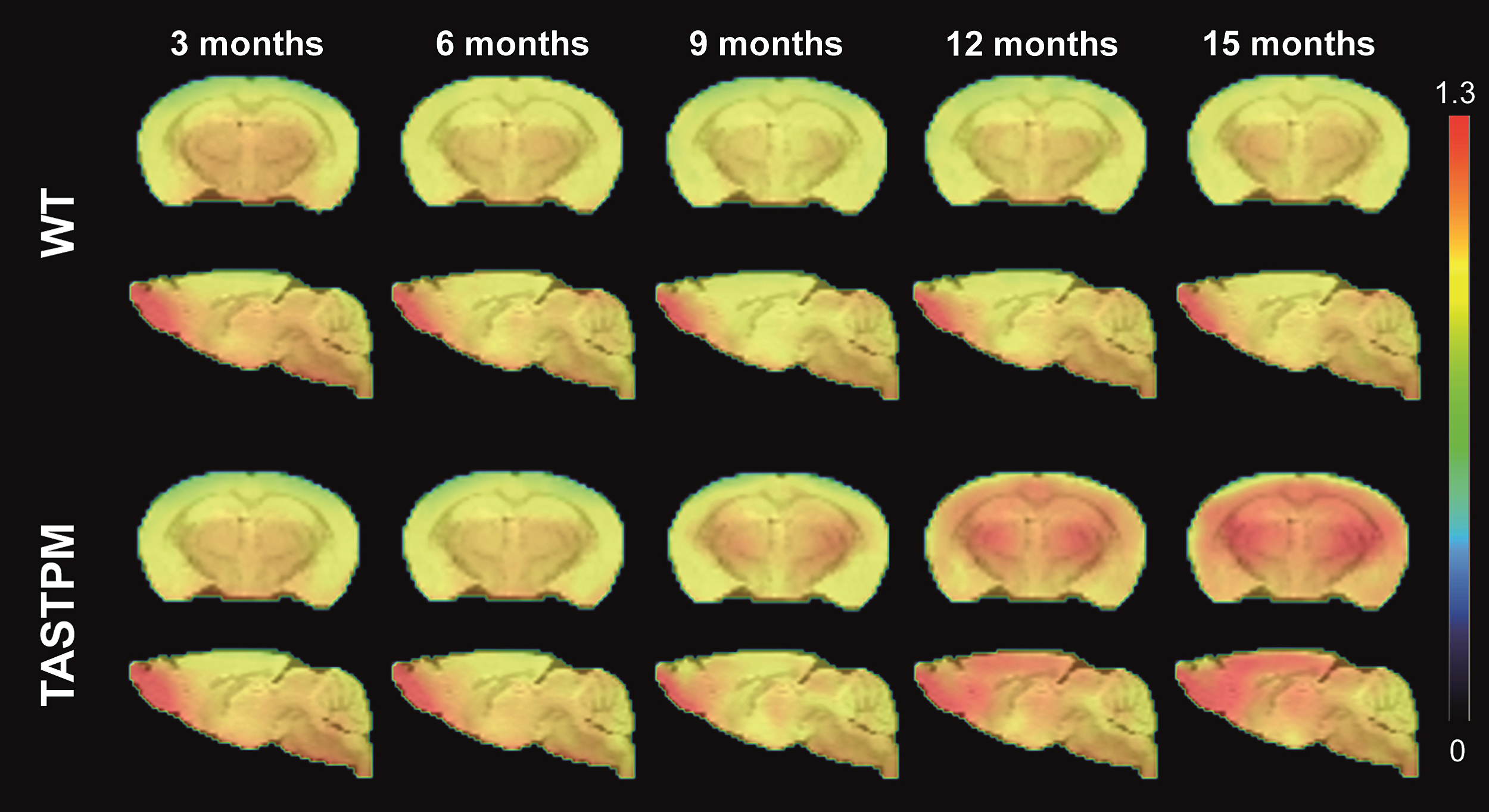Longitudinal imaging of [18F]-AV45 uptake in WT and TASTPM mice. Average μPET images of [18F]-AV45 uptake in WT and TASTPM mice at each time point. [18F]-AV45 uptake was corrected for injected dose and normalized to the cerebellum. μPET images are overlaid on a T2-weighted MRI template for anatomic localization. 3 months (TASTPM = 22, WT = 22), 6 months (TASTPM = 15, WT = 19), 9 months (TASTPM = 12, WT = 16), 12 months (TASTPM = 8, WT = 13), 15 months (TASTPM = 5, WT = 10).