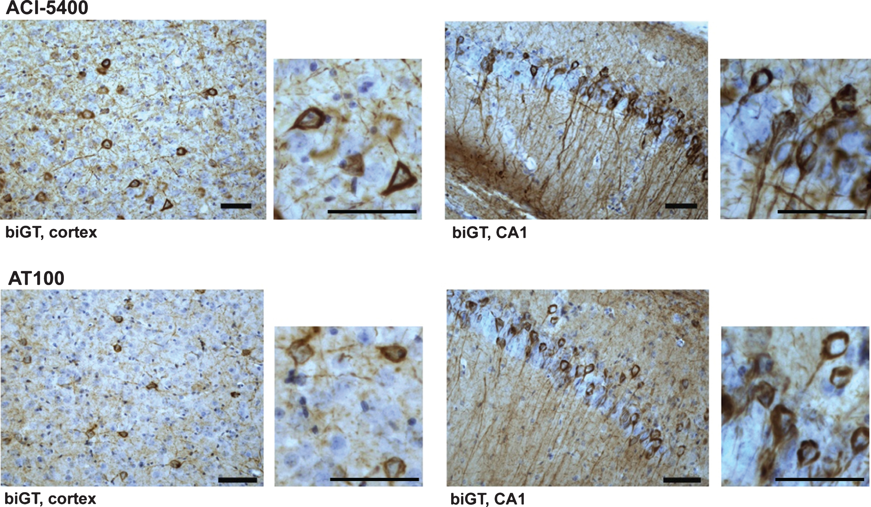 ACI-5400 defines Tau pathology by reaction with tangles and neuropil threads. ACI-5400 specifically revealed neurofibrillary tangles and neuropil threads in the cortex and CA1 hippocampus of biGT mice (upper panels), with AT100 as positive control (lower panels). Enlarged images demonstrated the exquisite nature of the fibrillar tauopathy in the somata of pyramidal neurons in cortex and CA1 of old biGT mice. The following antibody dilutions were used: ACI-5400 at 1/30’000 and AT100 at 1/1’000. Scale bars = 50 μm.