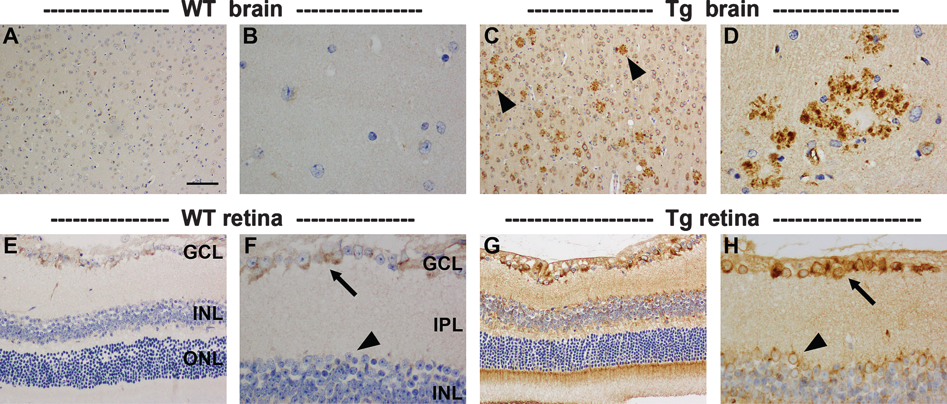 Representative images of AβPP immunolabeling in the brain and retina of 11-month-old WT and Tg mice. In WT parietal cortex (A) and hippocampus (B), AβPP localizes to the cytoplasm of neurons. In Tg mice, neuronal expression of AβPP is higher, and numerous dystrophic neurites surrounding amyloid plaques are present within the parietal cortex (C, arrowheads) and hippocampus (D). In the WT retina, AβPP localizes to the cytoplasm of RGCs (arrow), but is barely detectable within amacrine cells (arrowhead) or other neuronal cell types. In Tg mice, AβPP expression is markedly higher in RGCs (arrow), and is also clearly detectable in other neuronal populations (arrowhead); however, no AβPP-positive dystrophic neurites are evident. Scale bar: A, C = 100 μm; E, G = 50 μm, B,D,F,H = 25 μm.