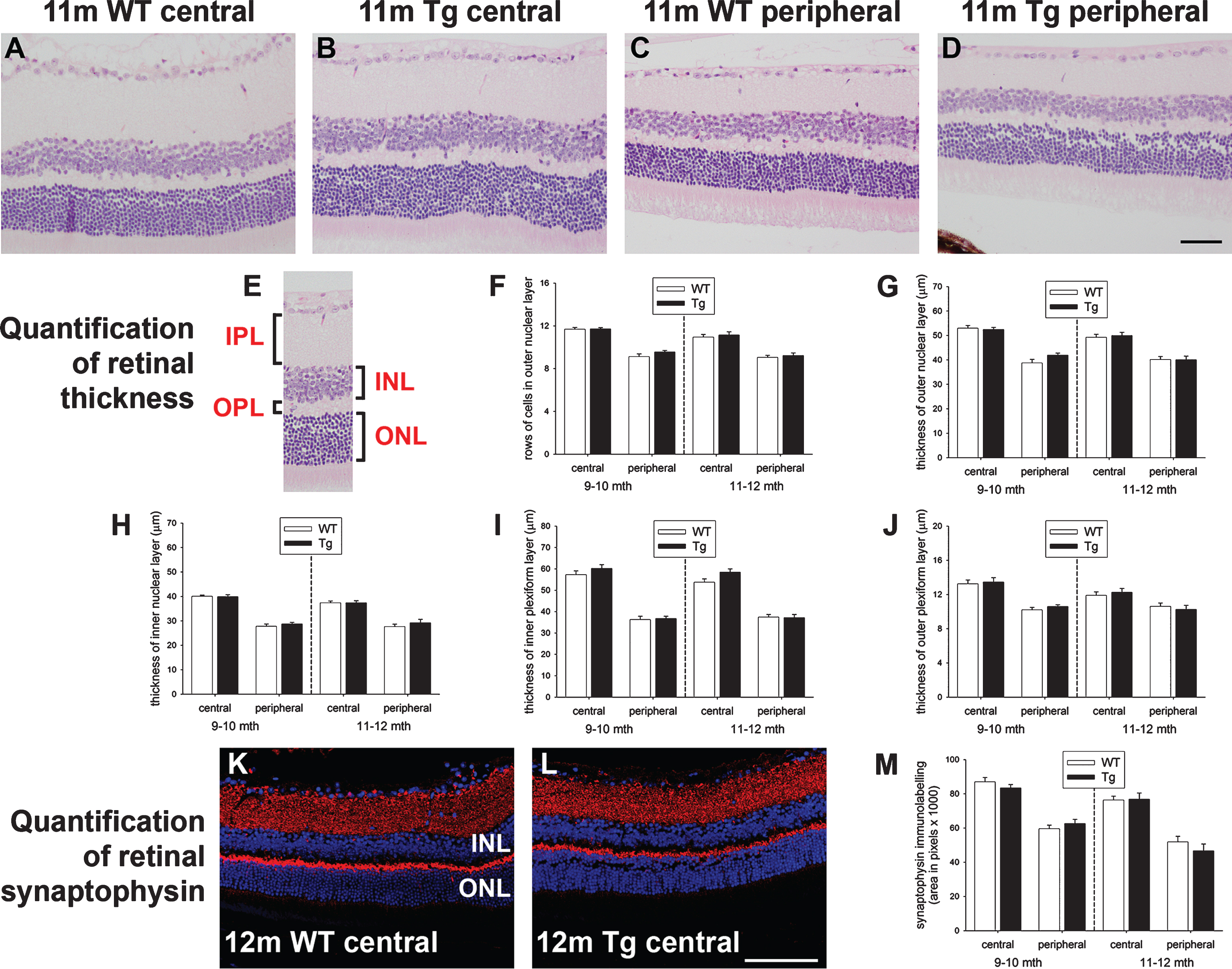 Analysis of retinal thickness and synaptic density in 9–to 12–month-old WT and Tg mice. Representative images of hematoxylin and eosin staining in the central (A, B) and peripheral (C, D) retinas of 11-month-old WT and Tg mice. E) Identification of the retinal layers. F, G) Quantification of the number of rows of cells and the thickness of the outer nuclear layer (ONL). H-J) Quantification of the thicknesses of the inner nuclear layer (INL), inner plexiform layer (IPL), outer plexiform layer (OPL). K-M) Representative images of synaptophysin immunolabeling in the central retinas of 12-month-old WT and Tg mice. Quantification of synaptophysin density in the central and peripheral retina is also shown. In each case, data are expressed as mean±SEM, where n = 10 for each age-matched group. Student’s unpaired t-tests revealed no significant differences. Scale bars: 50 μm.
