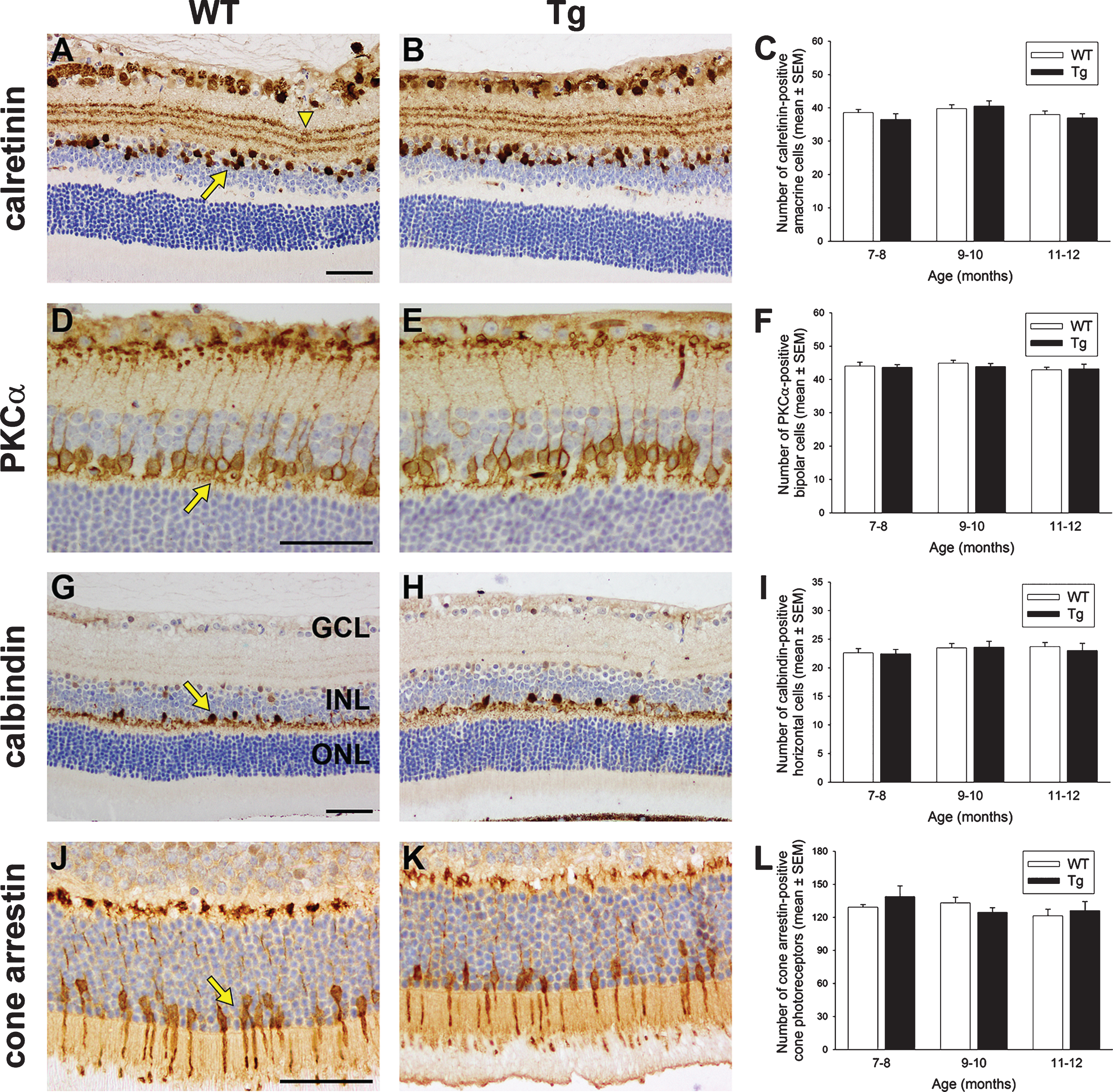 Analysis of amacrine cells, bipolar cells, horizontal cells, and cone photoreceptors in 7 to 12-month-old Tg retinas. Representative images of calretinin (A, B), PKCα (D, E), calbindin (G, H), and cone arrestin (J, K) immunolabeling are shown. Calretinin is associated with amacrine cell somata (arrow) located in the inner part of the INL, layers of terminals visible in the IPL (arrowhead), and displaced amacrine and ganglion cells in the GCL. PKCα labels bipolar cell somata (arrow) located in the INL and their processes that synapse with photoreceptors and retinal ganglion cells. Calbindin is associated with horizontal cell somata (arrow) located in the outer part of the INL and their dendrites in the outer plexiform layer. Cone arrestin labels cone photoreceptor cell bodies (arrow) located in the ONL, inner and outer cone segments, and synapses in the outer plexiform layer. Quantification of numbers of calbindin-labeled horizontal cells (C), calretinin-labeled amacrine cells (F), PKCα-labeled bipolar cells (I), and cone arrestin-labeled cone photoreceptors (L) are also shown. In each case, data are expressed as mean±SEM, where n = 10 for each age-matched group. Student’s unpaired t-tests revealed no significant differences between the treatment groups at any of the three age groups for any of the four cell types. Scale bars: 50 μm. GCL, ganglion cell layer; INL, inner nuclear layer; ONL, outer nuclear layer.