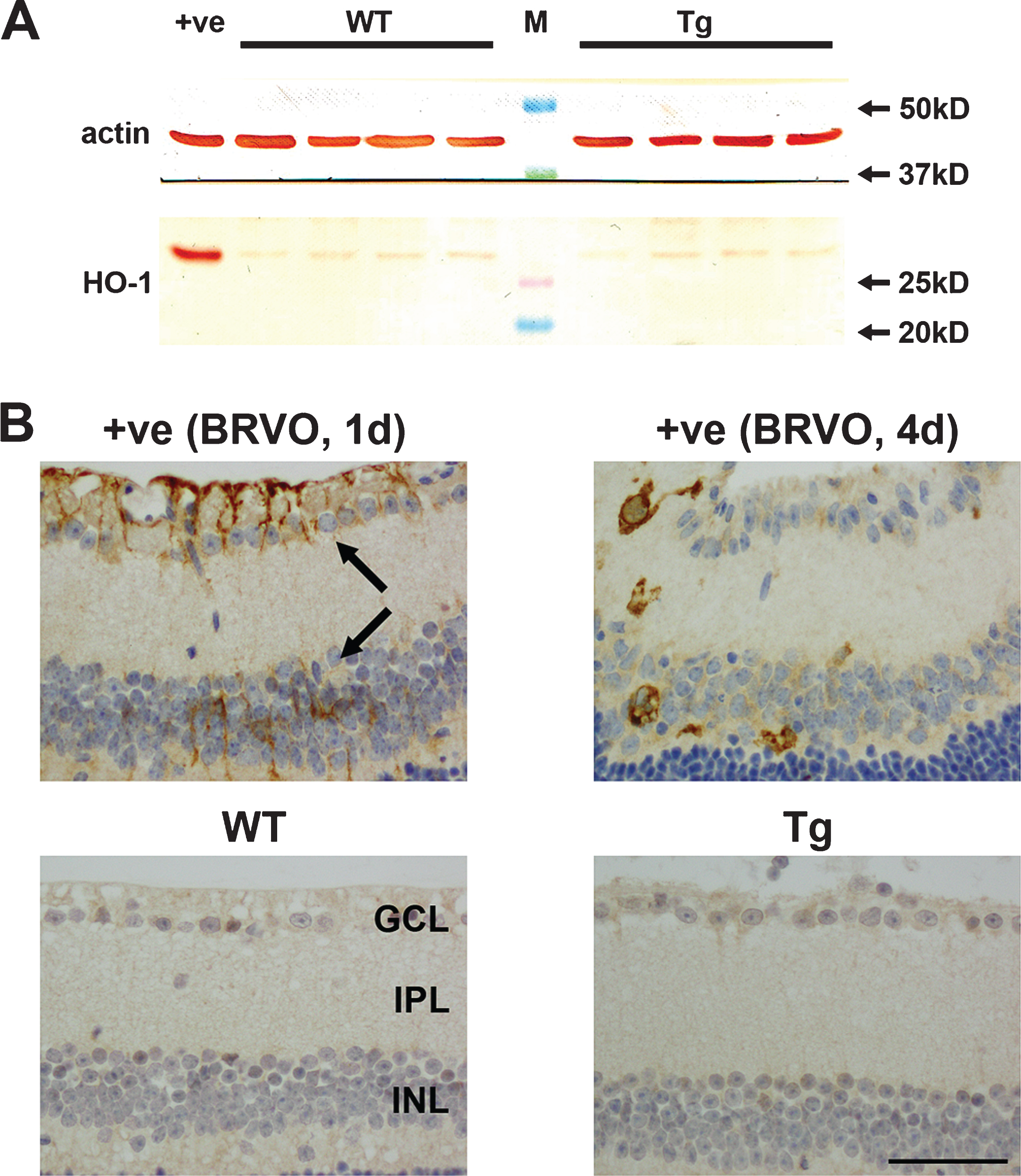 Analysis of heme oxygenase-1 (HO-1) expression in WT and Tg retinas. A) Expression of HO-1 protein in 12-month-old WT and Tg retinas as evaluated by western immunoblotting. An intense, single band of the expected molecular weight (32 kD) is apparent in an extract from a retinal culture treated with the pro-oxidant hydrogen peroxide (+ve). In WT and Tg retinas, a faint band of the correct molecular weight is evident. B) Representative images of HO-1 labeling in a retina subjected to branch retinal vein occlusion (BRVO, +ve control), and in 12-month-old WT and Tg retinas. HO-1 immunoreactivity is associated with astrocytes and Müller cells (arrows) in the retina analyzed 1d after induction of BRVO, and in activated microglia in the retina analyzed four days after induction of BRVO. Note: the area of retina shown is immediately adjacent to the vein occlusion site and not directly affected. No HO-1-positive cells are evident in WT or Tg retinas. Scale bar: 50 μm. GCL, ganglion cell layer; IPL, inner plexiform layer; INL, inner nuclear layer.
