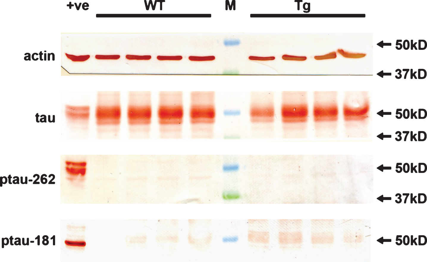 Analysis of hyperphosphorylated tau in WT and Tg retinas. Expression of tau, p-tau-T181, and p-tau-S262 proteins in 12-month-old WT and Tg retinas, as evaluated by western immunoblotting. Representative blots are shown from 12-month-old animals. Tau is abundant in extracts from WT and Tg retinas. In contrast, no unambiguous bands of the correct molecular weight are evident when membranes are incubated with antibodies directed against p-tau-T181 and p-tau-S262. Intense, single bands of the expected molecular weights are, however, apparent in an extract from a retinal culture treated with the potent phosphatase inhibitor calyculin A (+ve).