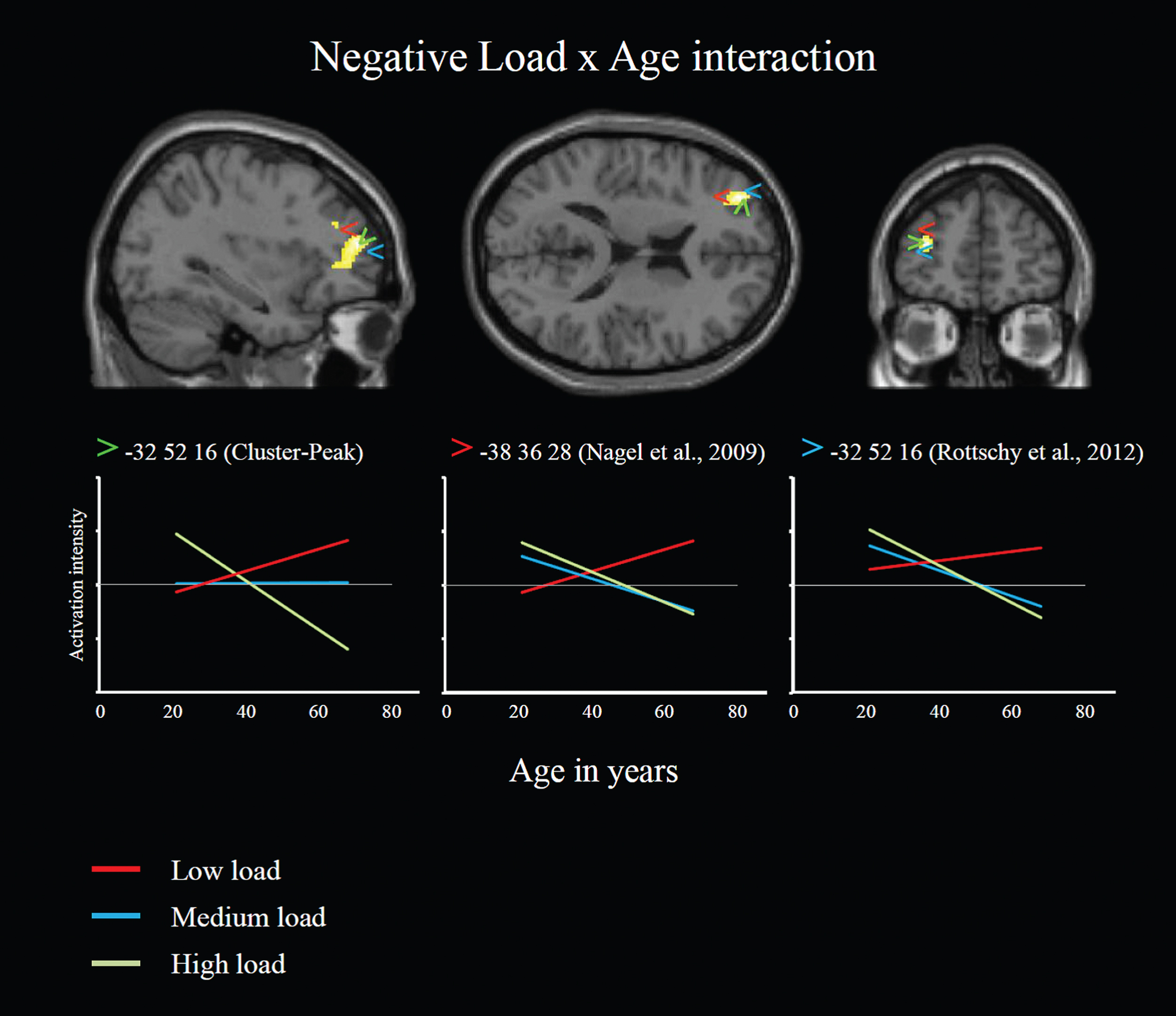 The CRUNCH effect. Whole-brain cluster-level analysis with a threshold of Z > 3.1 and a cluster significance threshold of pFWE < 0.05 revealed a negative load×age interaction within a large cluster located in anterior dorsolateral prefrontal cortex (unpublished material from Toepper et al. [85]). The diagrams illustrate activation intensity at low, medium, and high task load dependent from age within the peak of this cluster and two study-independent peaks identified by conjunction analyses across different age groups and load levels [69] and across 124 verbal and nonverbal working memory tasks [62]. Results showed analogue activation patterns for all three peaks indicating increasing activation intensity with advancing age at low load and decreasing activation intensity with advancing age at high load as well as higher activation intensity in older compared to younger individuals at low load and lower activation intensity in older compared to younger individuals at high load (double dissociation).