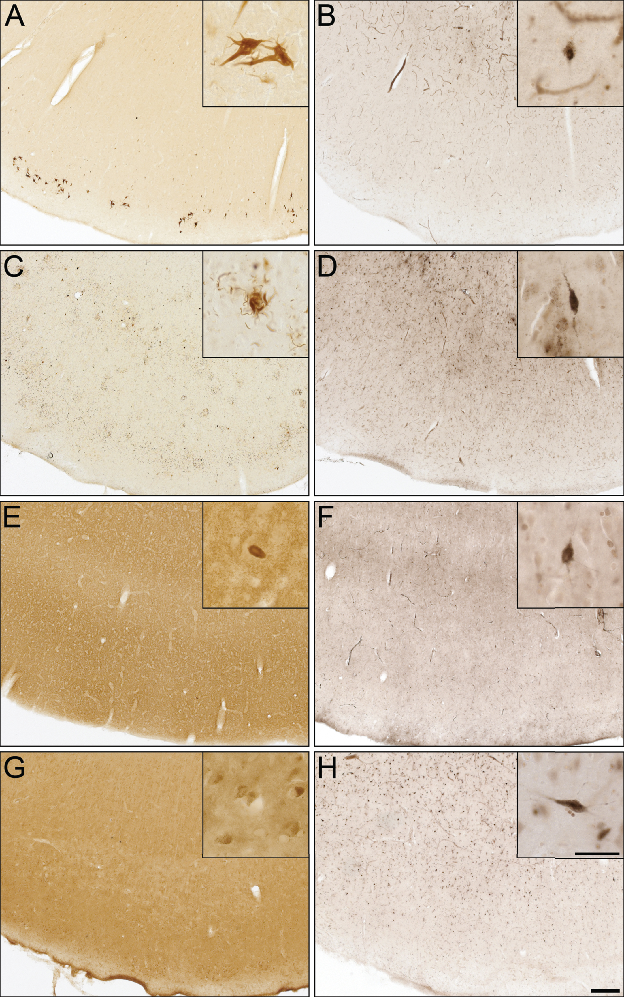 Photomicrographs of postmortem human entorhinal cortex from corticobasal degeneration (A,B), frontotemporal dementia with tau (C,D), dementia with Lewy bodies (E,F), and vascular dementia (G,H) stained for tau 3R (A), tau 4R (C), α-synuclein (E), Aβ (G), and butyrylcholinesterase (BChE) activity (B,D,F,H). Note, insets are higher magnification photomicrographs demonstrating examples of the pathology observed in each of the neurodegenerative diseases including neurofibrillary tangles (A), neuropil threads and degenerating neurites (C), Lewy bodies (E), and intraneuronal inclusions (G). Note, BChE staining was limited to a few scattered cortical neurons (insets B,D,F,H) and did not label pathological structures in these neurodegenerative diseases. Scale bars = 250 μm, insets 50 μm.