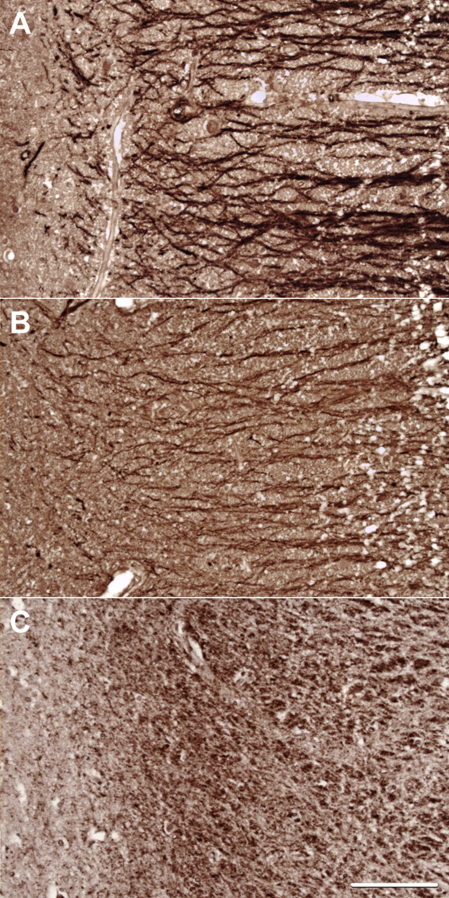 Representative images of staining for (A) MAP2, (B) Drebrin, and (C) PSD-95 in the stratum radiatum of CA1.