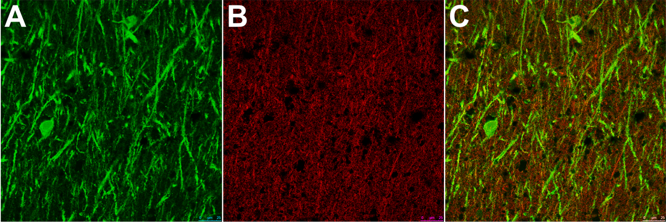 Representative double labelled immunofluorescence staining of (A) MAP2, (B) drebrin, and (C) combined in the stratum radiatum of CA1. As can be seen, the staining for drebrin is very punctate but does have some overlap with MAP.