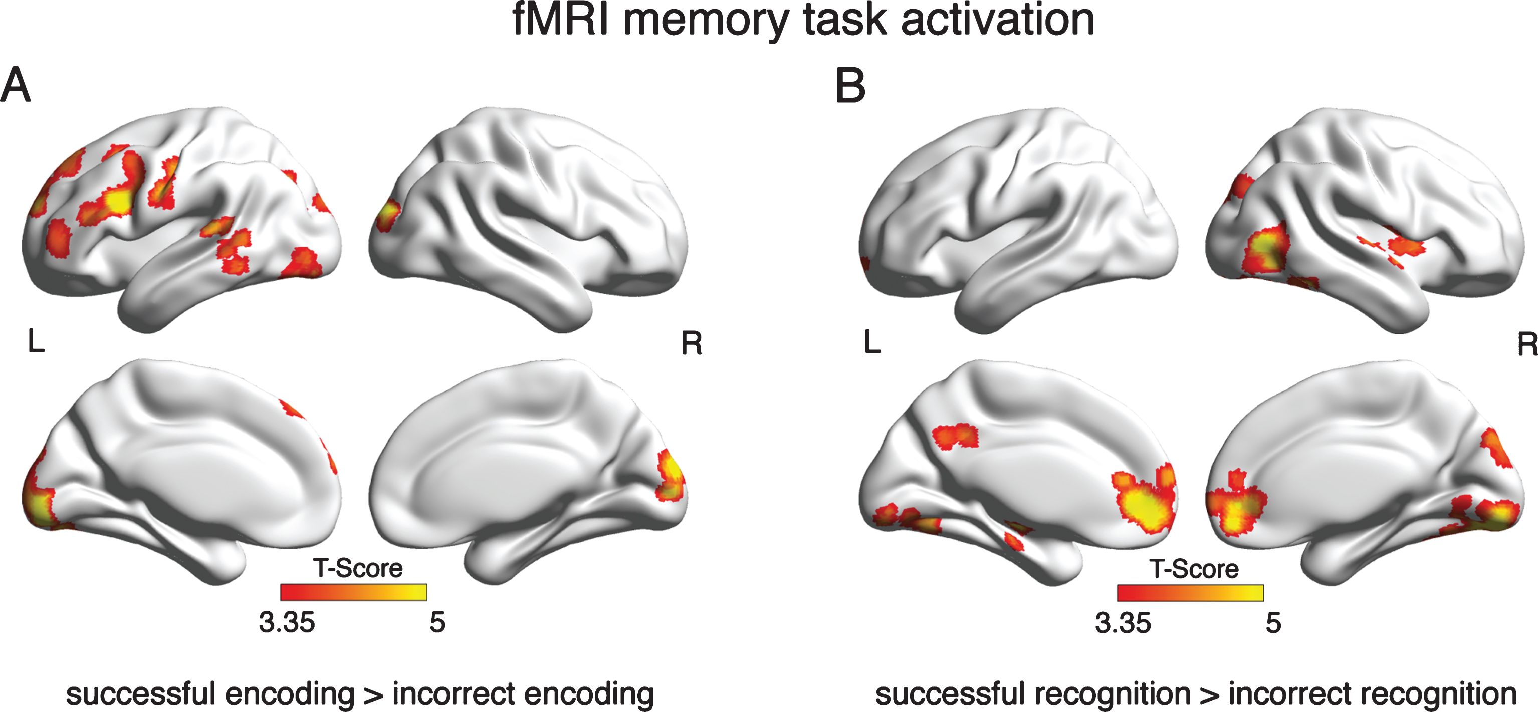 Brain areas that showed significant activation in the GLM analysis of the fMRI memory task. Depicted are clusters where brain activation was significantly greater during successful than incorrect encoding (A) or recognition (B) at a voxel threshold of α= 0.001 and a FWE corrected cluster threshold at α= 0.05.