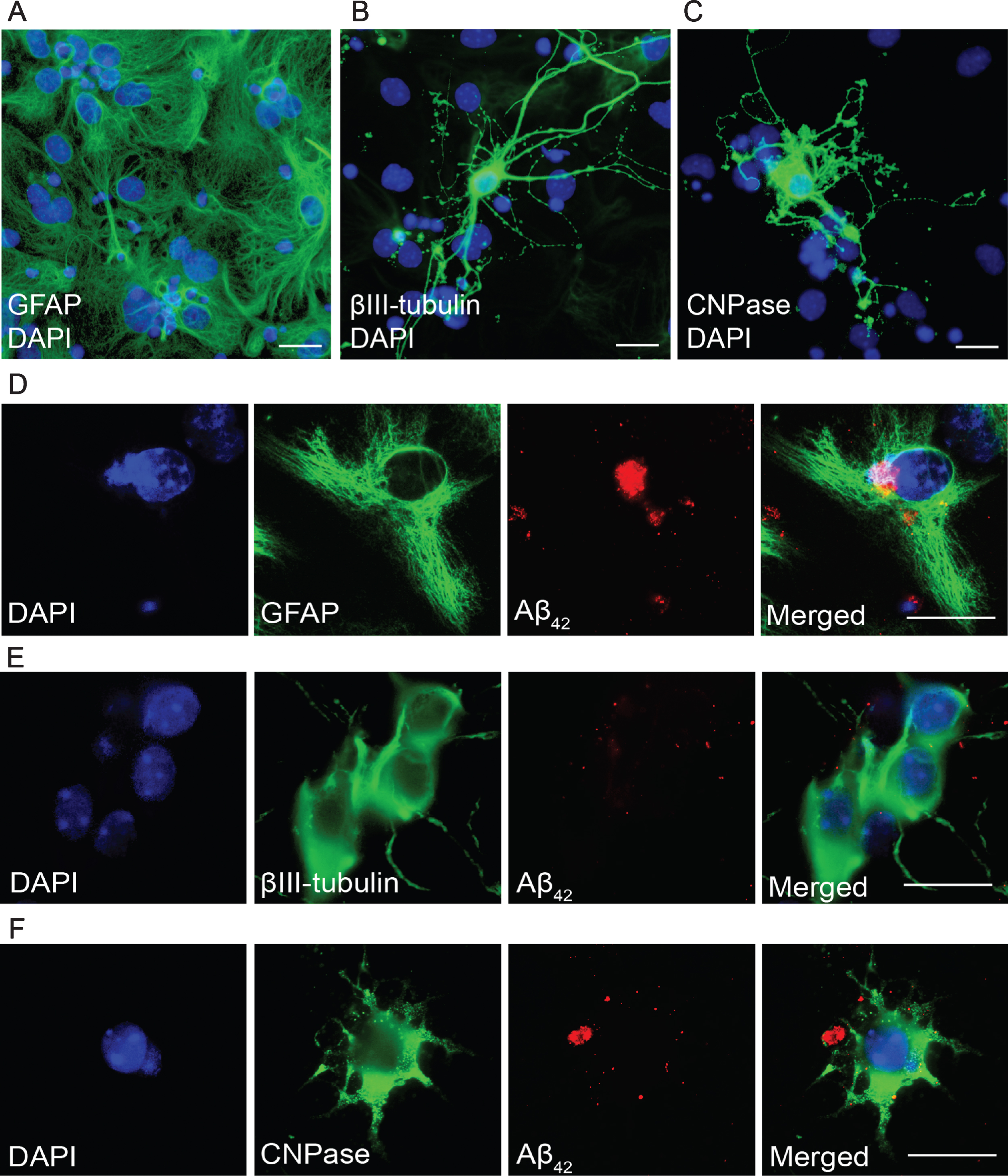 Aβ42 protofibrils are accumulated in astrocytes. Immunocytochemistry demonstrating the three cell types in the unexposed co-culture system; astrocytes (A), neurons (B), and oligodendrocytes (C). Astrocytes exposed to Aβ42 protofibrils for 2 days contained large deposits of Aβ42 (D). Neurons lacked detectable levels of intracellular Aβ42 (E), but the few oligodendrocytes in the culture showed some Aβ42 accumulation (F). DAPI (blue), GFAP, βIII-tubulin, CNPase (all green), and Aβ42 (red). Scale bars: A-F = 20μm.