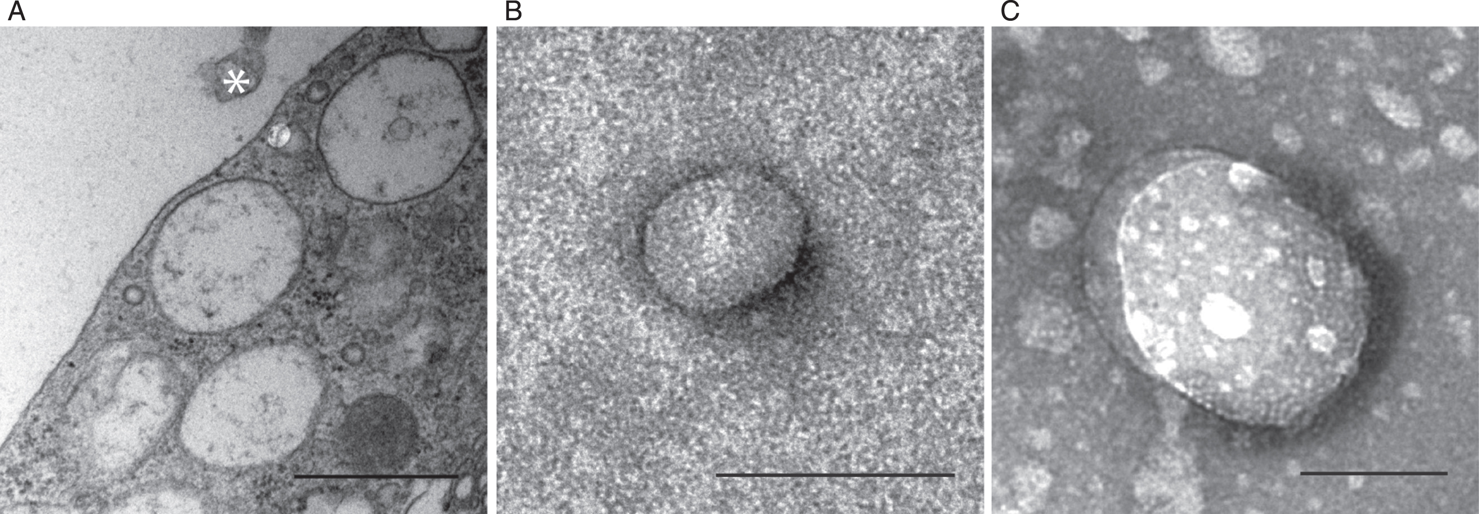 Secreted EVs can be successfully isolated from neuroglial co-cultures. Transmission electron microscopy confirming the presence of an EV (asterisk) in close proximity to multivesicular astrocytes (A). The EV preparation included smaller vesicles, such as exosomes (B) and larger MVs (C). The size of the exosomes ranged from 50–75 nm and the larger MVs were up to 400 nm in diameter. Scale bars: A = 1μm, B-C = 100 nm.