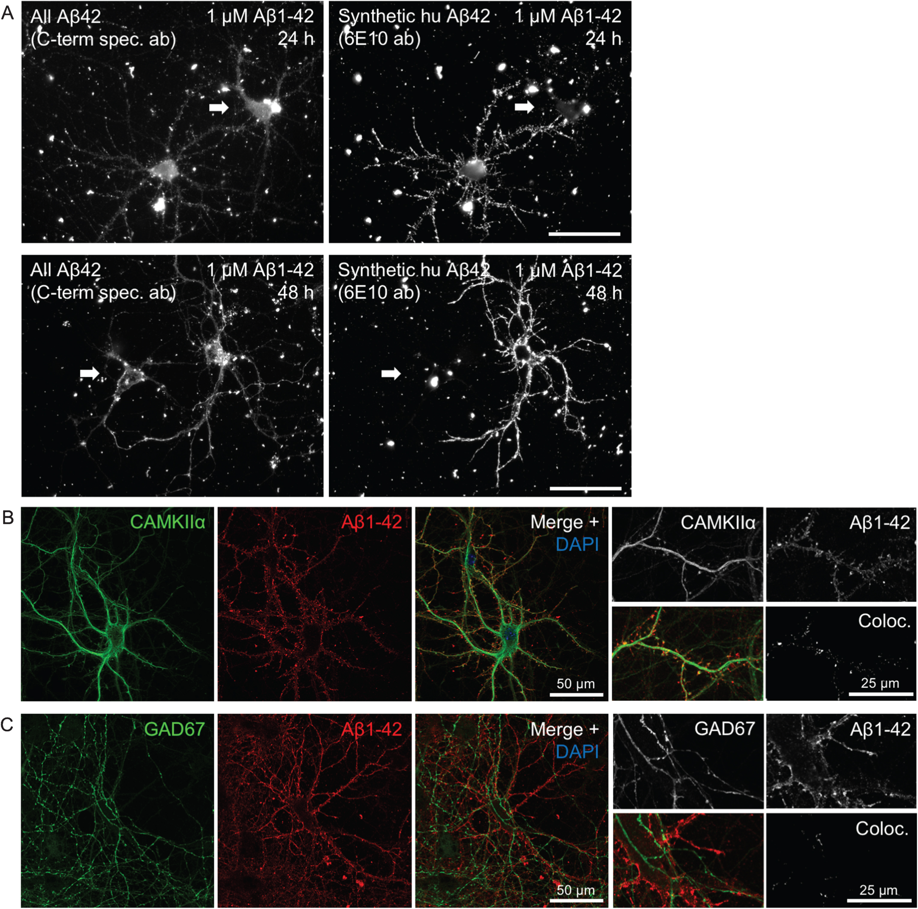 Heterogeneity in Aβ1 - 42 binding and internalization. A) Only certain neurons in culture accumulate synthetic Aβ1 - 42 in a punctate pattern along the processes. Epifluorescent imaging of wt primary mouse neurons treated with 1 μM human Aβ1 - 42 for 24 h or 48 h. Labeling with a C-terminal specific Aβx - 42 antibody (left panels) showing both endogenous mouse Aβ42 and the added human synthetic Aβ1 - 42, displays two large neurons in each of these images. However, the exogenously added human Aβ1 - 42, recognized by antibody 6E10 (right panels), accumulates predominantly only in one of the two neurons, including their processes. Note the brighter labeling with the high affinity antibody 6E10 of only one of the two neurons in the right image panels. Scale bars 50 μm. B-C) Accumulation of exogenously added Aβ1 - 42 for 30 min is more pronounced in excitatory CamKII-positive compared to inhibitory GAD67-positive neurons. B) Aβ1 - 42 accumulation in some but not all, and not exclusively in, neurons labeled with CamKIIα. Higher magnification images (right) with Aβ1 - 42 in CamKIIα-positive synaptic terminals that appear more consistent with dendritic spines. C) Aβ1 - 42 was not seen accumulating in any GAD67-positive neurons.