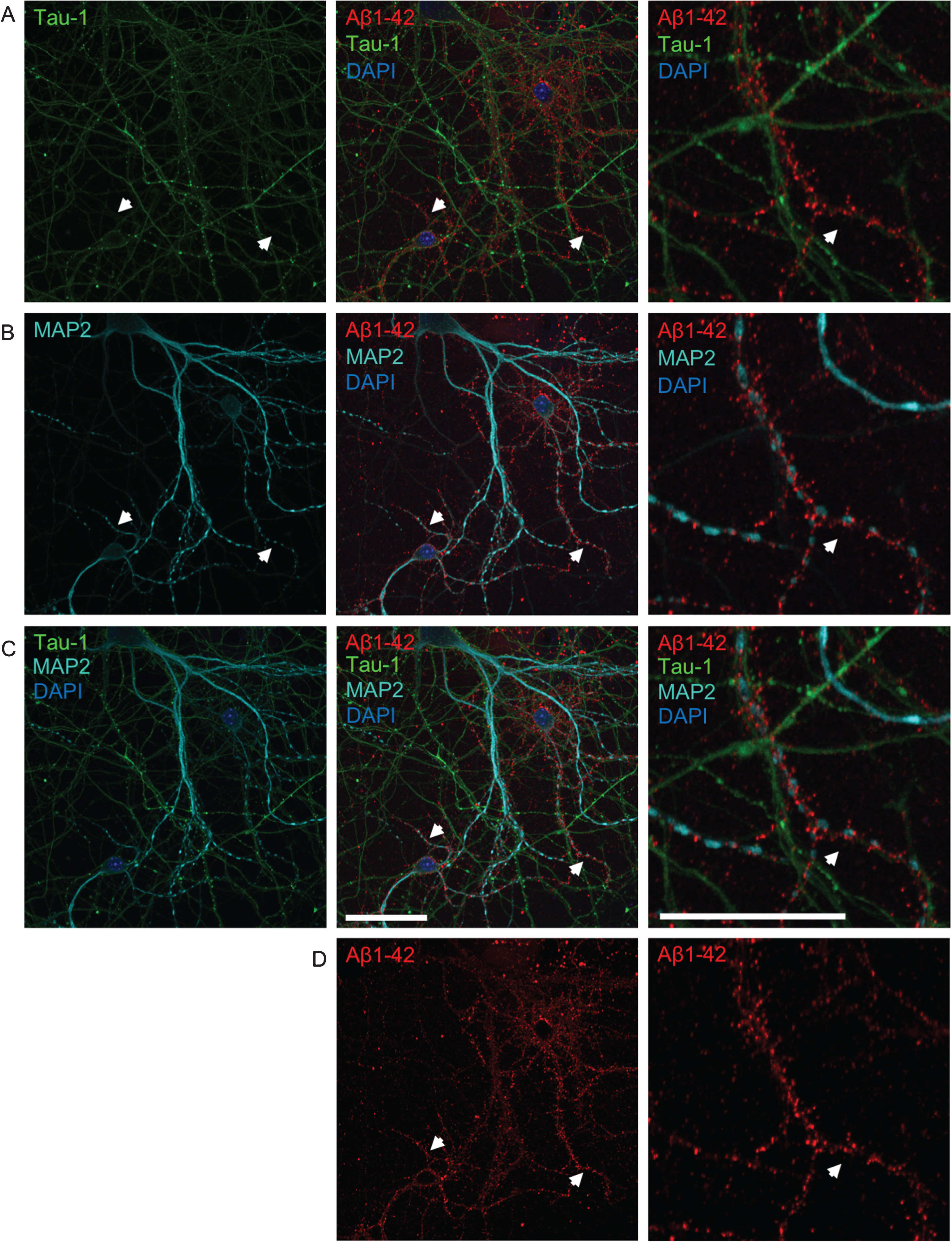 The pattern of Aβ accumulation in neurons is more consistent with dendritic labeling. A-D) Double-labeling with axonal tau-1 (A) and dendritic MAP2 (B) markers of primary neurons treated with 0.5 μM of fluorescently tagged Aβ1 - 42 (Aβ555) for 30 min. All images show the same field of view. Merged images of both tau-1, MAP2, Aβ1 - 42, and DAPI are shown in row C. The panel to the far right show higher magnification images of the middle panel. The pattern of Aβ labeling (shown separately in row D) is more consistent with that of dendritic MAP2 than tau-1 labeling. White arrows denote MAP2-positive dendrites accumulating Aβ555, which are not positive for tau-1. High magnification images (right) show tau-1-positive axons devoid of Aβ555. Scale bars 50 μm.
