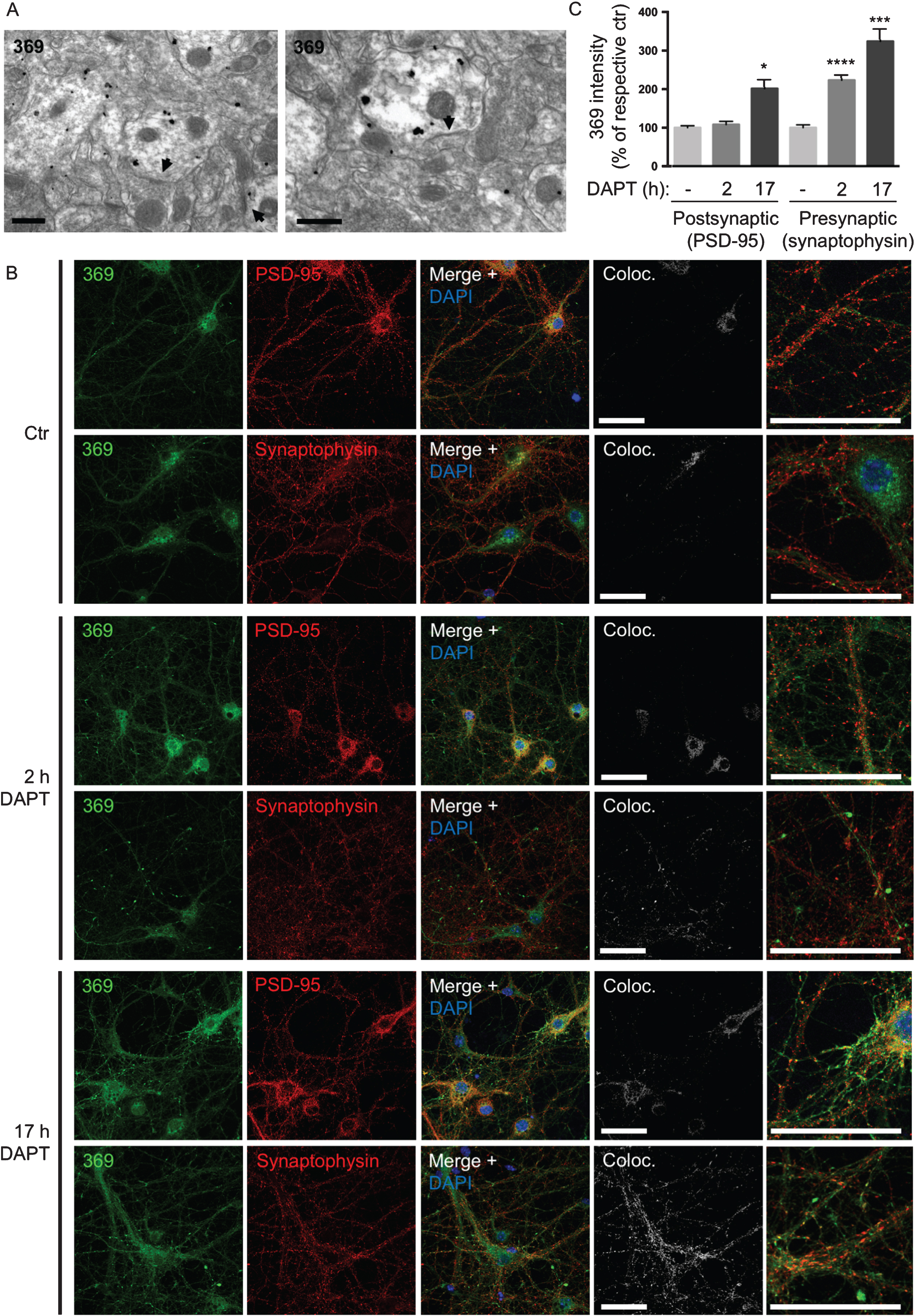 γ-secretase inhibition leads to earlier AβPP CTF accumulation at pre- than post-synaptic sites. A) In the CA3 region of hippocampus AβPP CTFs are mainly accumulating in post-synaptic compartments in PS1 cKO; AβPP Tg mice. Arrowheads denote post-synaptic densities. Scale bars 500 nm. B) Immunofluorescent labeling of AβPP/PS1 primary cortical neurons treated with the γ-secretase inhibitor DAPT. AβPP CTF-accumulation is seen by C-terminal specific AβPP antibody 369 in both axons and dendrites after 17 h. However, with only 2 h of DAPT treatment, AβPP CTF-accumulation is evident only in pre-synaptic compartments. Scale bars 50 μm. C) Quantification of the intensity of antibody 369 labeling in post-synaptic compared to pre-synaptic compartments with DAPT-treatment indicates a relatively greater increase in pre-synapses, which is also evident earlier (at 2 h). Thresholds were set by automatic thresholding by default on confocal images in the MAP2 or tau-1 channel. The mean intensity of the antibody 369 channel was subsequently measured in the pixels that were above threshold in the MAP2 or tau-1 channel respectively. Values are presented as percentage of respective untreated control.