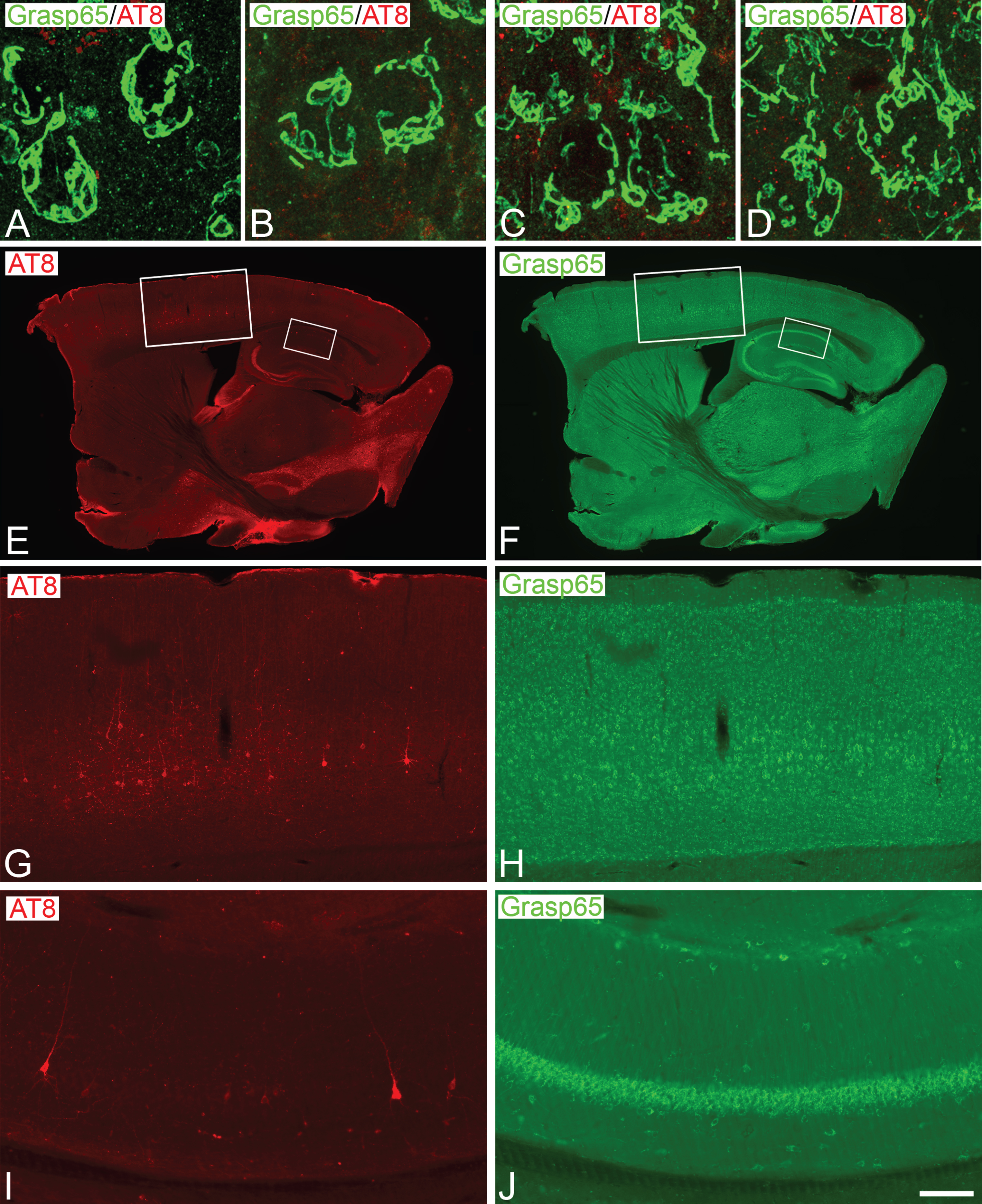 Distribution of Grasp65 in the GA of neurons from P301S and wild-type mice. A–D) Confocal stack projection images taken from Grasp 65/AT8 double-immunostained sections from the hindlimb region of the somatosensory neocortex (A, B) and the CA1 hippocampal region (C, D) of wild-type (A, C) and P301 (B, D) animals aged 2 weeks. Note the absence of AT8+ neurons in both regions at this age and the similar appearance of the Grasp65-ir GA elements between wild-type and P301S animals. E−J show pairs of conventional fluorescence images taken from a Grasp 65/AT8 double-immunostained parasagital section from the brain of 36-week-old P301 mice showing the distribution of AT8+ neurons in the somatosensory cortex (G, H) and the CA1 hippocampal region (I, J). Squared zones in E and F are shown at higher magnification in G−J. Scale bar shown in J indicates 7 μm in A−D, 1035 μm in E−F, 210 μm in G−H and 100 μm in I−J.